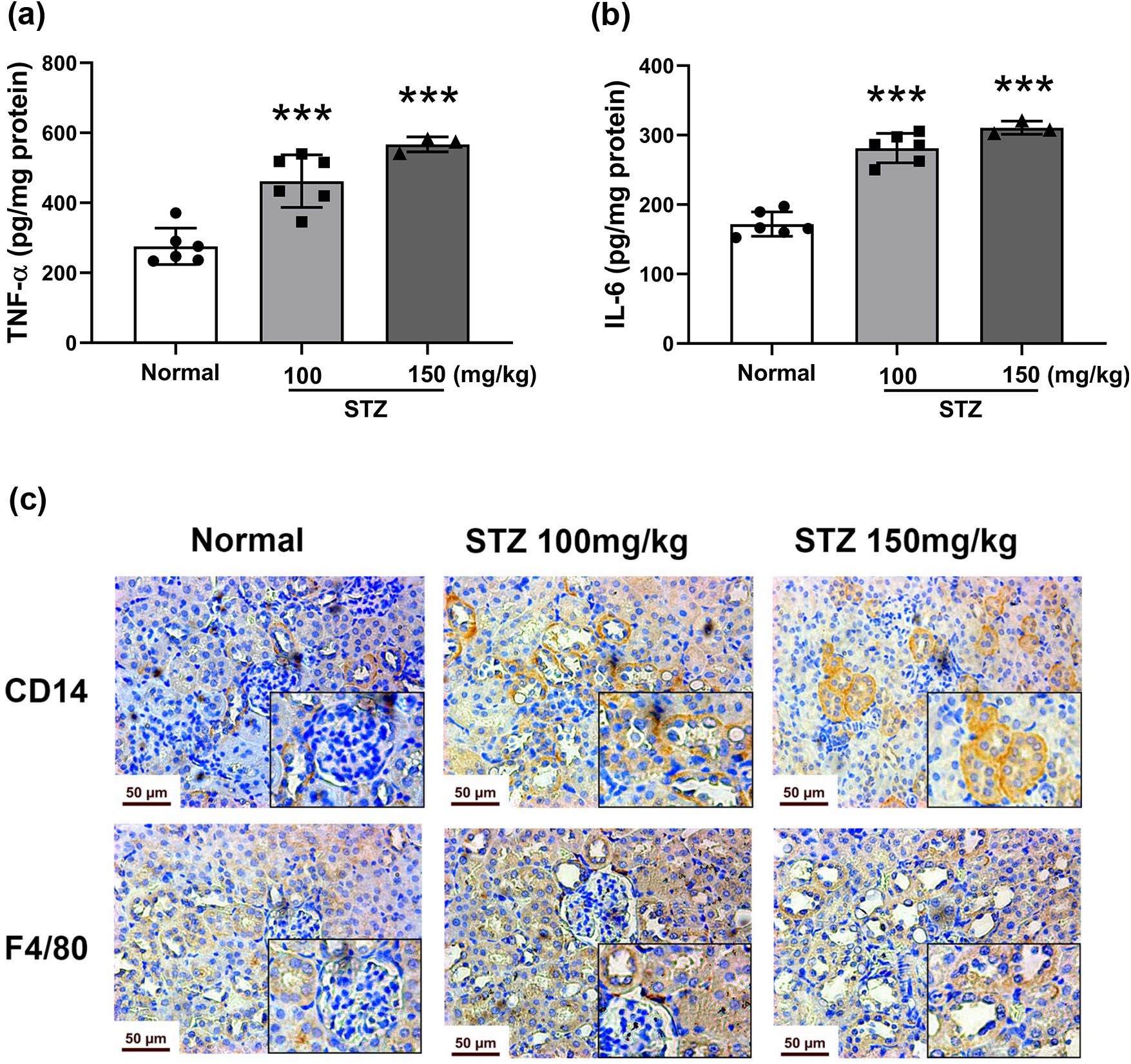 Figure 4
Level of inflammatory cytokines and macrophage infiltration in the kidneys of STZ-induced diabetic mice. Mice were treated with STZ at 100 or 150 mg/kg by intraperitoneal injection. The kidney was dissected on Day 64. The levels of the inflammatory cytokines TNF-α (a) and IL-6 (b) in renal tissues tested by ELISA, n = 6. Immunohistochemical staining (c) of CD14 and F4/80 in the kidneys of STZ-induced mice, photographed at 400× magnification, n = 3. Data are expressed as the mean ± SD. *P < 0.05, **P < 0.01, ***P < 0.001, vs the normal group, tested by one-way ANOVA and Fisher’s PLSD.