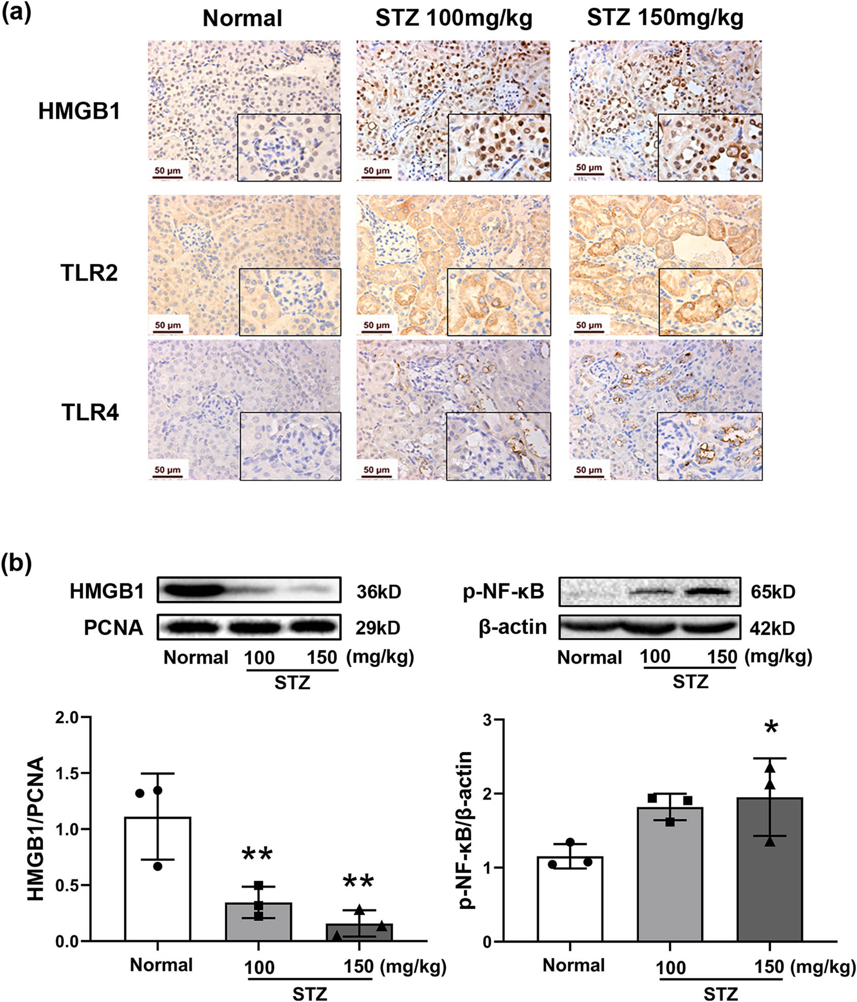 Figure 5
Activation of the HMGB1/TLR2/4 signaling pathway in the kidneys of STZ-induced diabetic mice. Mice were treated with STZ at 100 or 150 mg/kg by intraperitoneal injection. The kidney was dissected on Day 64. Immunohistochemical staining of HMGB1, TLR2, and TLR4 in the kidneys (a), photographed at 400× magnification. Protein expression of HMGB1 and p-NF-κB in the kidneys by Western blot (b), n = 3. PCNA and β-actin were used as internal controls. Data are expressed as the mean ± SD. *P < 0.05, **P < 0.01, ***P < 0.001, vs the normal group, tested by one-way ANOVA and Fisher’s PLSD.