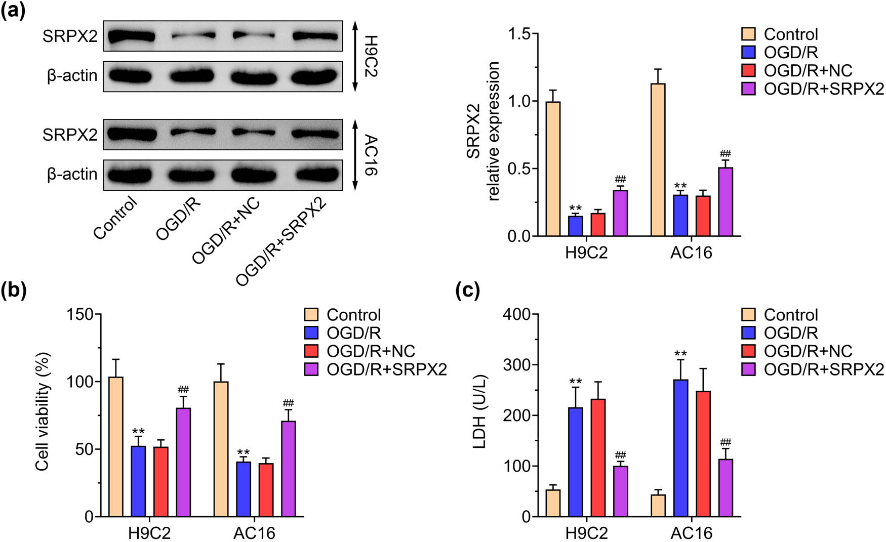 Figure 1 
                  SRPX2 increases OGD/R-induced cell viability in H9C2 and AC16 cells: (a) expression of SRPX2 in OGD/R model and SRPX2 overexpression, (b) MTT assay detected the impact of SRPX2 on cell viability in H9C2 and AC16 cells with indicated treatment, and (c) LDH activity detected the impact of SRPX2 on cell viability in H9C2 and AC16 cells with indicated treatment. **, p < 0.01, ***, p < 0.001 vs control; #, p < 0.05, ##, p < 0.01, ###, p < 0.001 vs OGD/R.
               