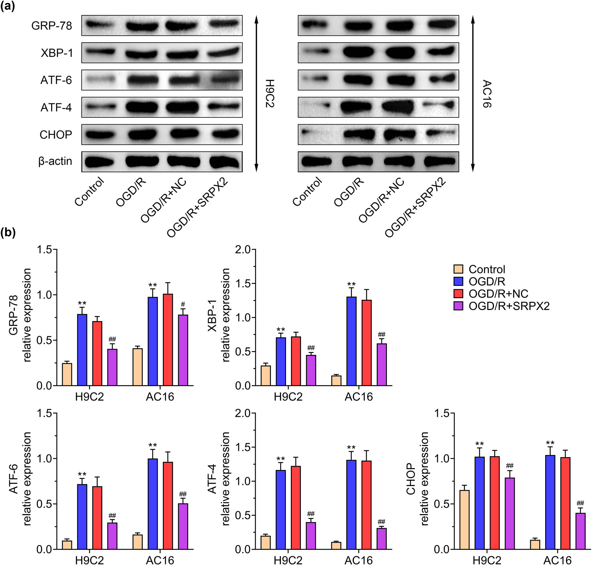 Figure 3 
                  SRPX2 suppresses ER stress induced by OGD/R: (a and b) level of ER stress, GRP-78, XBP-1, ATF-6, ATF-4, CHOP in H9C2, and AC16 cells with indicated treatment. **, p < 0.01, ***, p < 0.001 vs control; #, p < 0.05, ##, p < 0.01, ###, p < 0.001 vs OGD/R.
               