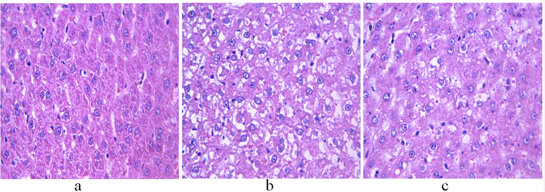 Figure 1
H&E staining of the liver of 11-week-old rats. (a) Control group; (b) non-treatment group; and (c) treatment group. Scale bar = 400 μm.