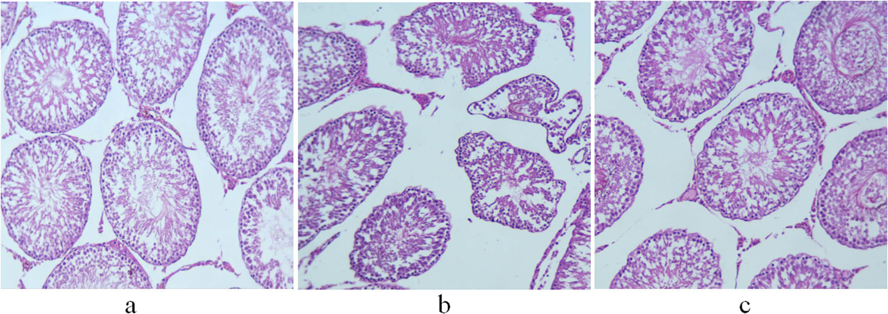 Figure 2
H&E staining of the testis of 11-week-old rats. (a) Control group; (b) non-treatment group; and (c) treatment group. Scale bar = 100 μm.