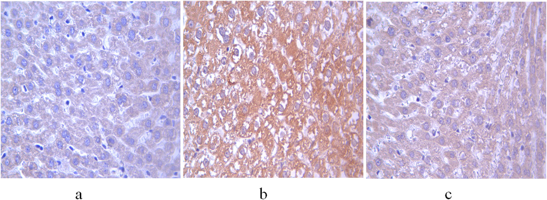 Figure 3
Expression of aromatase in the liver of 11-week-old rats. (a) Control group; (b) non-treatment group; and (c) treatment group. Scale bar = 400 μm.