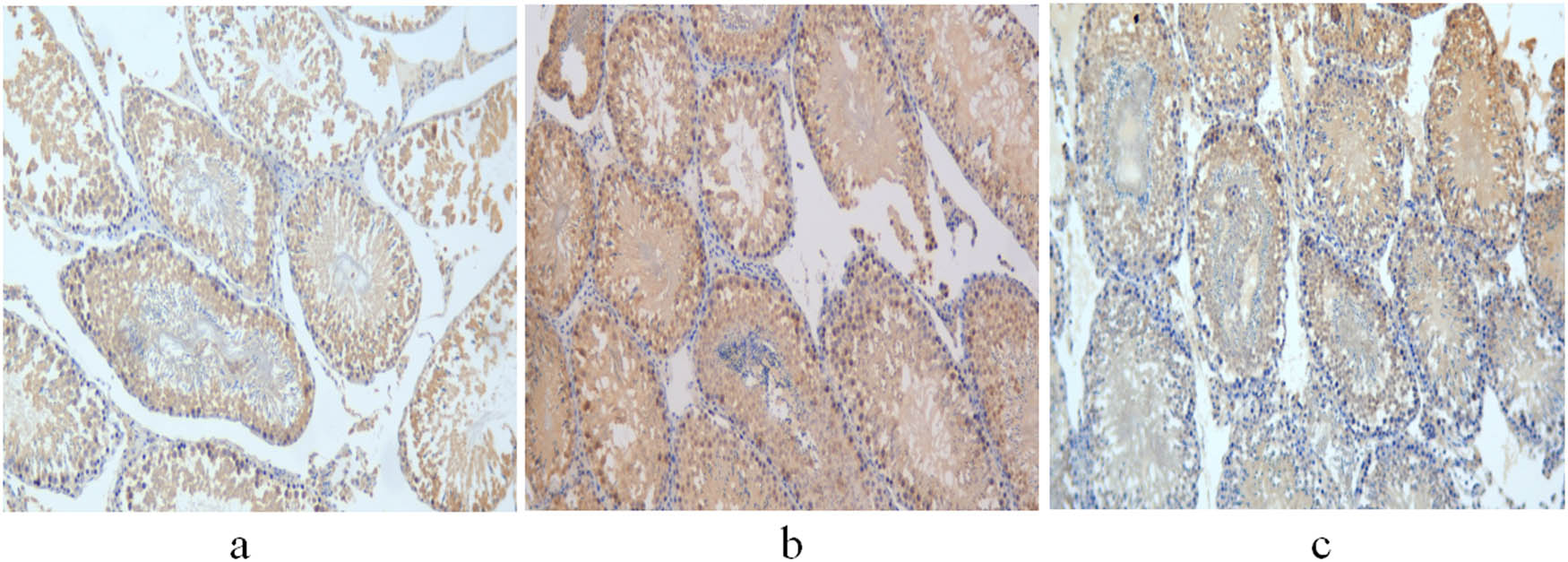 Figure 5
Expression of aromatase in the testis of 11-week-old rats. (a) Control group; (b) non-treatment group; and (c) treatment group. Scale bar = 100 μm.