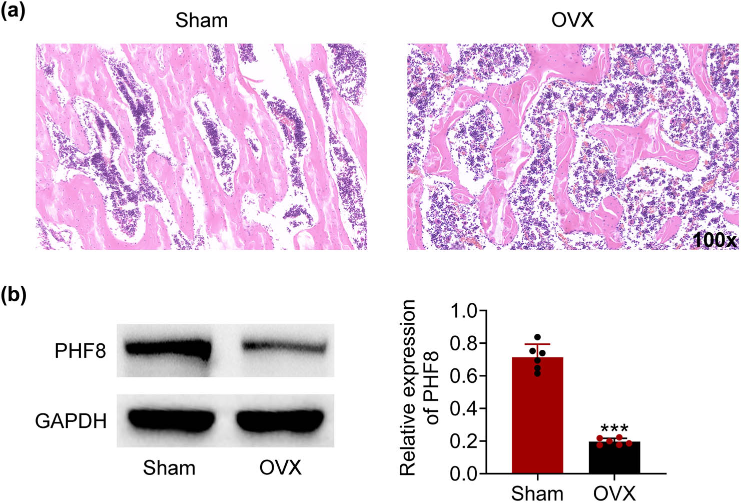 Figure 1
The down-regulated expression of PHF8 in the OVX group. (a) H&E staining of bone microarchitectures in the femur showing a bone mass loss in the OVX group versus sham groups. (b) The protein level of PHF8 in the OVX and sham groups was detected by Western blotting. ***P < 0.001 versus the sham group.