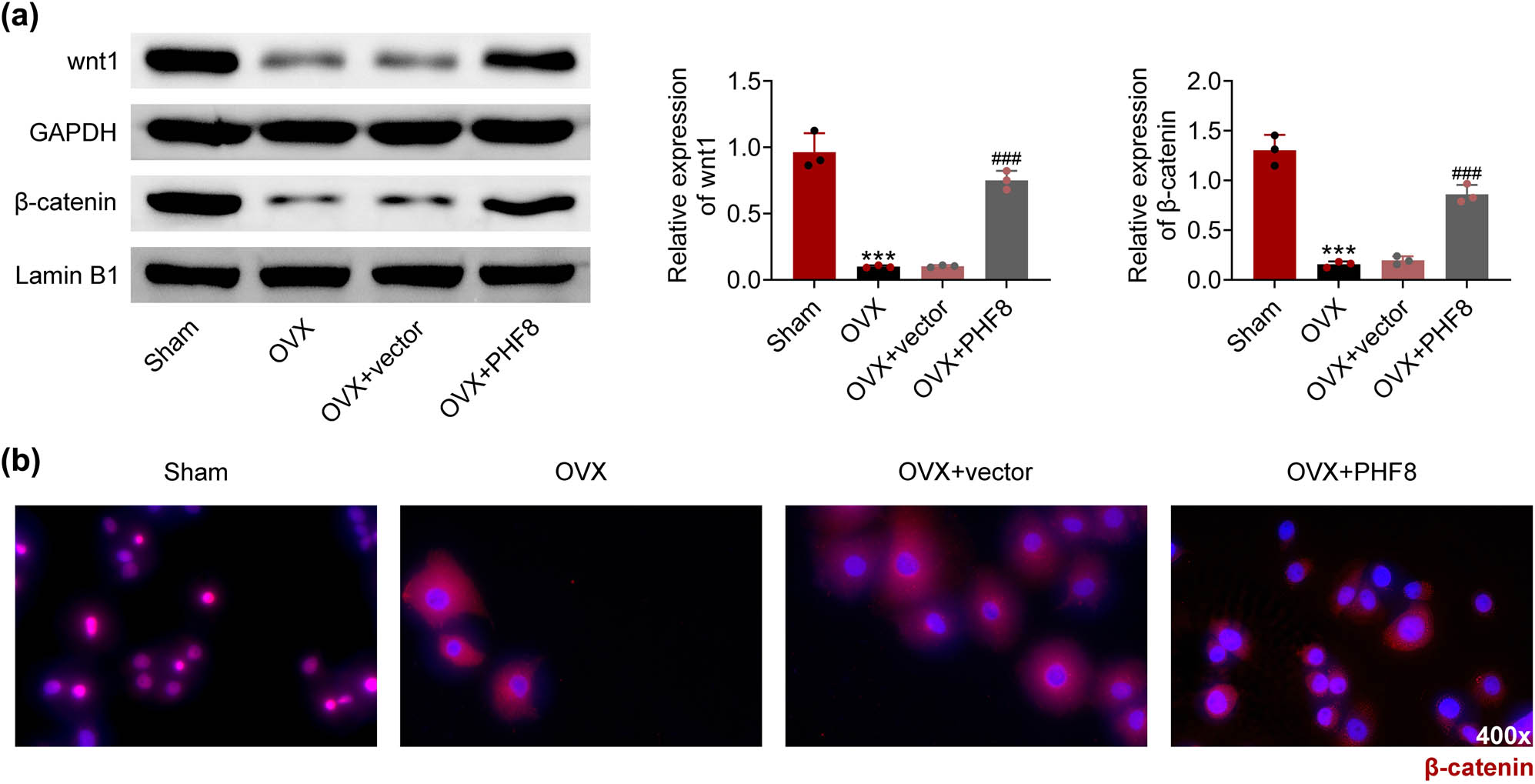 Figure 4
PHF8 activates Wnt/β-catenin signaling pathway. (a) The relative protein levels of Wnt and β-catenin in BMSCs detected by western blotting. (b) The β-catenin positive cells in BMSCs showed by immunofluorescence. ***P < 0.001 versus the sham group; ###
P < 0.001 versus the OVX group.