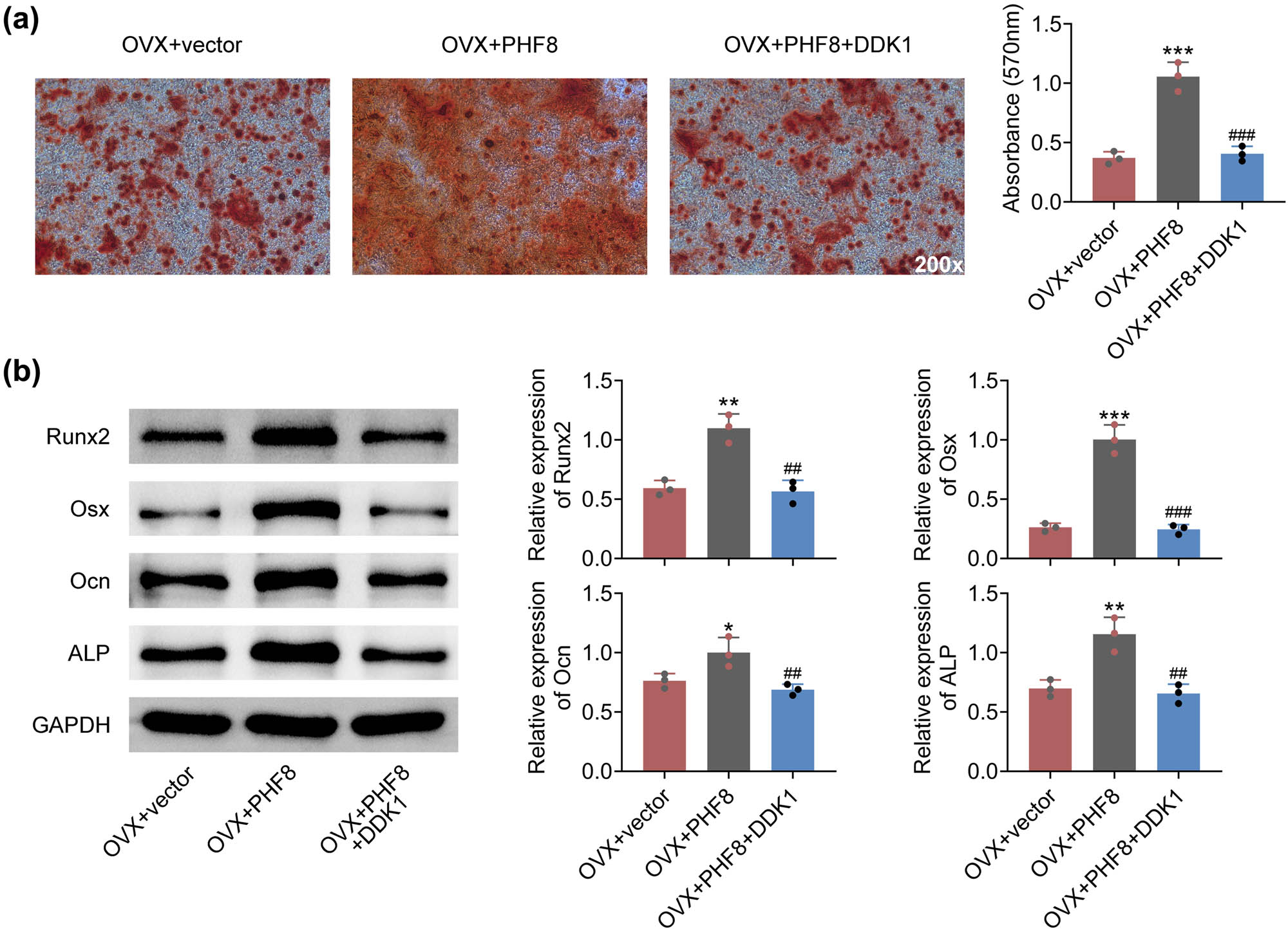 Figure 5
PHF8 induces osteogenic differentiation of BMSCs via Wnt/β-catenin signaling pathway. (a) The osteogenesis efficiency of BMSCs was measured by the Alizarin Red S staining. (b) The relative protein levels of RUNX2, Osx, Ocn, and ALP in BMSCs detected by Western blotting. *P < 0.05, **P < 0.01 and ***P < 0.001 versus the sham group; ###
P < 0.001 versus the OVX group.