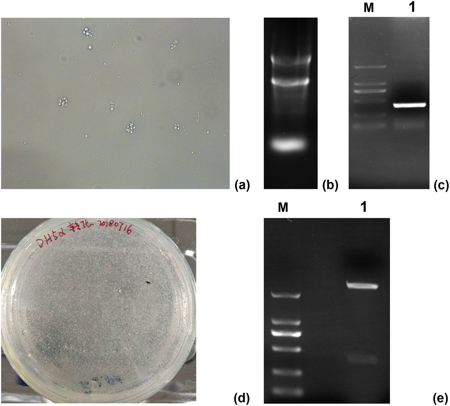 Figure 1
Cloning and identification of the CTLA-4 IgV gene: (a) Con A stimulated lymphocytes (200×); (b): electrophoresis of total RNA; (c) plasmid PCR gel electrophoresis, M: 2,000 bp DNA marker, 1: PCR target band; (d) constructed CTLA-4 IgV gene fragment PMD19-T was transformed into competent DH5a cells, and positive clones were screened by blue and white spots; (e) plasmid BamHI and KpnI gel electrophoresis after double digestion, M: 2,000 bp DNA marker, 1: Plasmid electrophoresis was performed after double enzyme digestion.