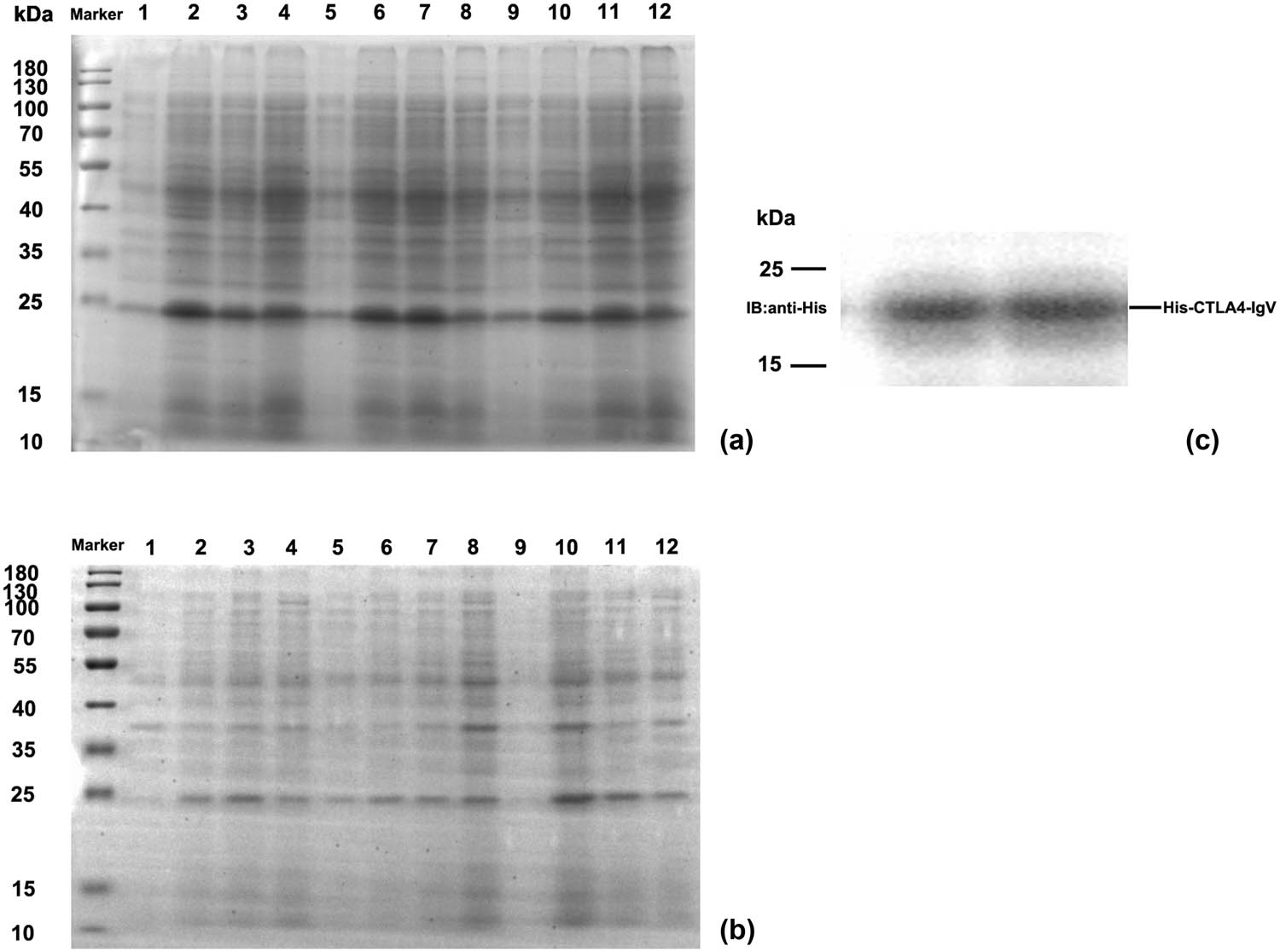Figure 3
SDS-PAGE and Western blot analysis of the CTLA-4 IgV recombinant protein: (a) SDS-PAGE analysis of the recombinant protein CTLA-4 IgV in the supernatant; M: Protein molecular mass standards 1–4 are pET30a–CTLA-4 IgV induced at the IPTG concentration of 0.2 mmol/L for 0 h, at 28°C for 4 h, at 28°C for 2 h plus 37°C for 2 h, and at 37°C for 4 h, respectively. Protein molecular mass standards 5–8 are pET30a–CTLA-4 IgV induced at the IPTG concentration of 0.5 mmol/L for 0 h, 28°C for 4 h, 28°C for 2 h plus 37°C for 2 h, and 37°C for 4 h, respectively. Protein molecular mass standards 9–12 are pET30a–CTLA-4 IgV induced at the IPTG concentration of 0.8 mmol/L for 0 h, at 28°C for 4 h, at 28°C for 2 h plus 37°C for 2 h, and at 37°C for 4 h, respectively. (b) SDS-PAGE analysis of the recombinant protein CTLA-4 IgV in the precipitate; M: Protein molecular mass standards 1–4 are pET30a–CTLA-4 IgV induced at the IPTG concentration of 0.2 mmol/L for 0 h, at 28°C for 4 h, at 28°C for 2 h plus 37°C for 2 h, and at 37°C for 4 h, respectively. Protein molecular mass standards 5–8 are pET30a–CTLA-4 IgV induced at the IPTG concentration of 0.5 mmol/L for 0 h, at 28°C for 4 h, at 28°C for 2 h plus 37°C for 2 h, and at 37°C for 4 h, respectively. Protein molecular mass standards 9–12 are pET30a–CTLA-4 IgV induced at the IPTG concentration of 0.8 mmol/L for 0 h, 28°C for 4 h, 28°C for 2 h plus 37°C for 2 h, and 37°C for 4 h, respectively. (c) Western blot analysis of CTLA-4IgV recombinant protein; M: Protein molecular quality standard; 1–2: CTLA-4 IgV protein.