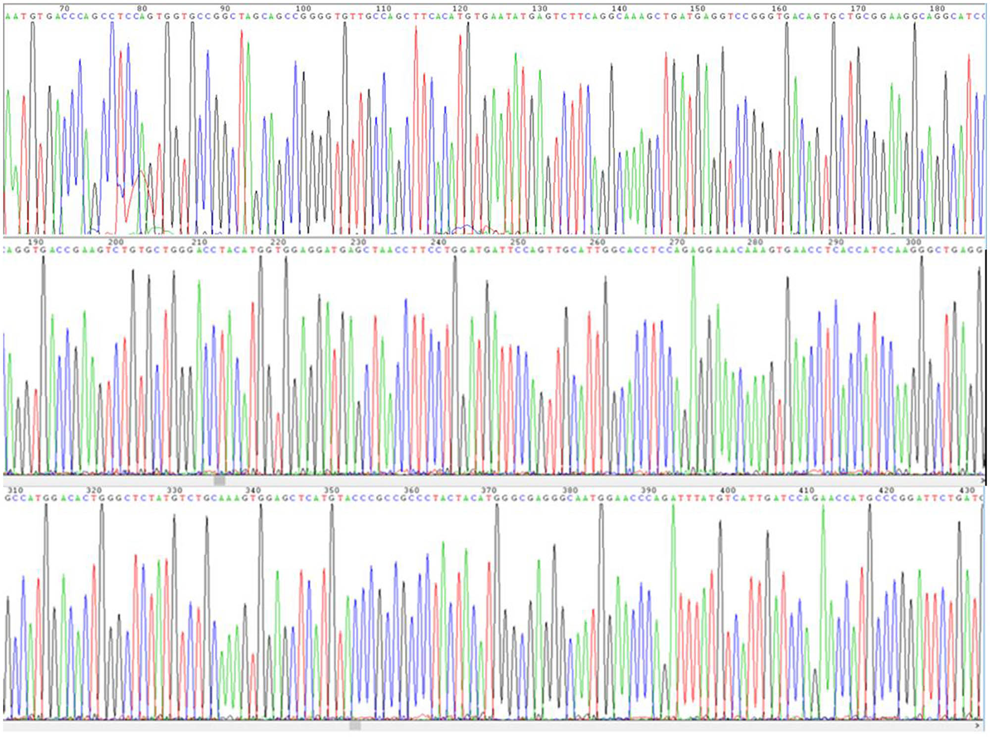Figure A1
Sequencing results of the recombinant plasmid pET30a–CTLA-4 IgV.