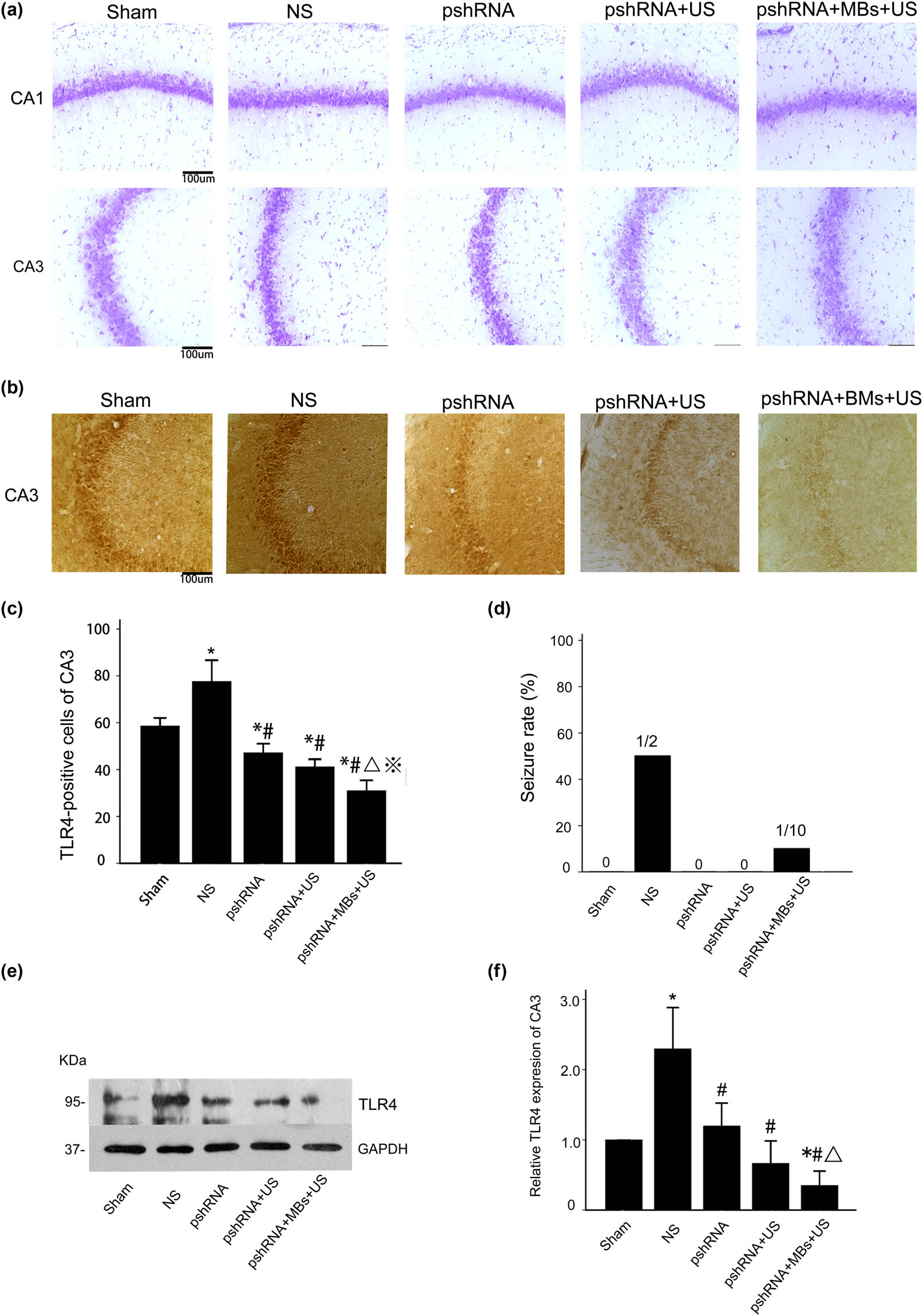 Figure 1
The effect of TLR4 silencing in rats with hyperglycemic ischemia: (a) Nissl staining showed no cell death in any group at 6 h post-ischemia. (b) TLR4 expression in the CA3 subregion of hyperglycemic rats (the NS group) that developed tonic-clonic seizure after ischemia was significantly increased compared with the Sham group. (c) The number of TLR4-positive cells in the pshRNA, pshRNA + US, and pshRNA + MBs + US groups after ischemia significantly decreased compared with the NS group. *p < 0.05 vs the Sham group; #p < 0.05 vs the NS group; Δ
p < 0.01 vs the pshRNA group; ※ p < 0.05 vs the pshRNA+US group. (d) More rats in the NS group developed tonic-clonic seizures after ischemia compared with the pshRN+MBs+US group (50 vs 10%). (e and f) Western blot analysis of TLR4 expression in the CA3 region of all groups. Protein expression of TLR4 in NS-treated rats that developed tonic-clonic seizure after ischemia significantly increased compared with the Sham group. TLR4 was significantly upregulated in the pshRNA, pshRNA + US, and pshRNA + MB + U S groups. GAPDH was used as a loading control. Data are presented as mean ± SD from five independent experiments. One-way ANOVA was used to analyze statistical differences. *p < 0.05 vs the Sham group; #p < 0.05 vs the NS group; Δ
p < 0.01 vs the pshRNA group.