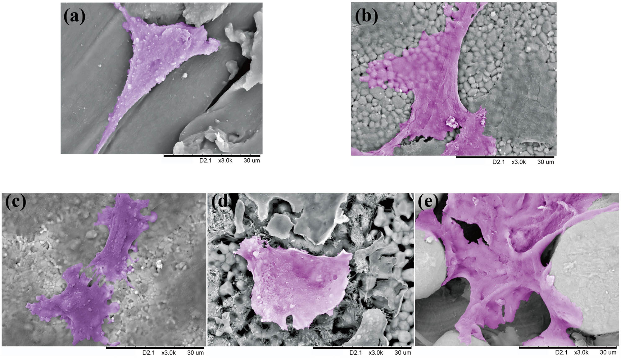 Figure 6
Representative SEM images of the growth of MC3T3 cells on the plates surface. (a) Cells on PEEK had sharp morphologies and fewer pseudopodia. (b–d) Cells with numerous extended pseudopodia were completely expanded and flat on ZrO2, Al2O3, and β-TCP. (e) Cells extend and grow between the sphere particulates on Ti6Al4V.