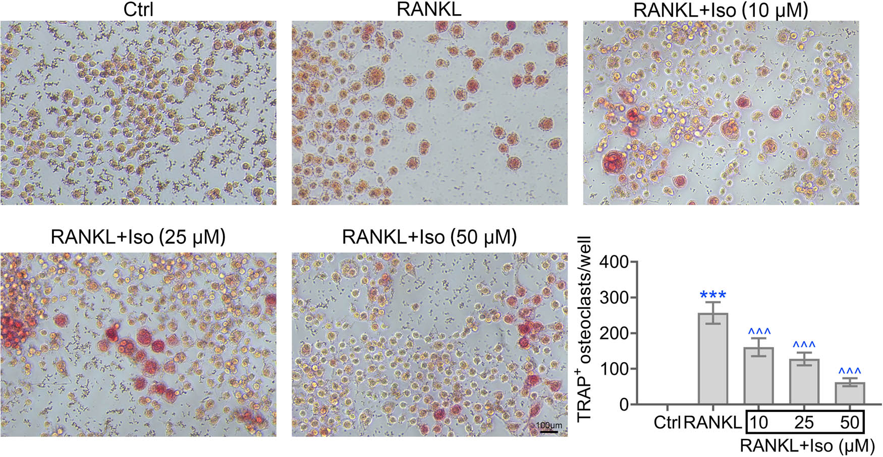 Figure 4 
                  Isoimperatorin inhibits the differentiation of macrophage into osteoclasts. TRAP staining of hPDLCs in response to RANKL and elevated level of isoimperatorin are shown. Each experiment was repeated three times. ***p < 0.001 vs control, ^p < 0.05, ^^p < 0.01, ^^^p < 0.001 vs LPS.
               