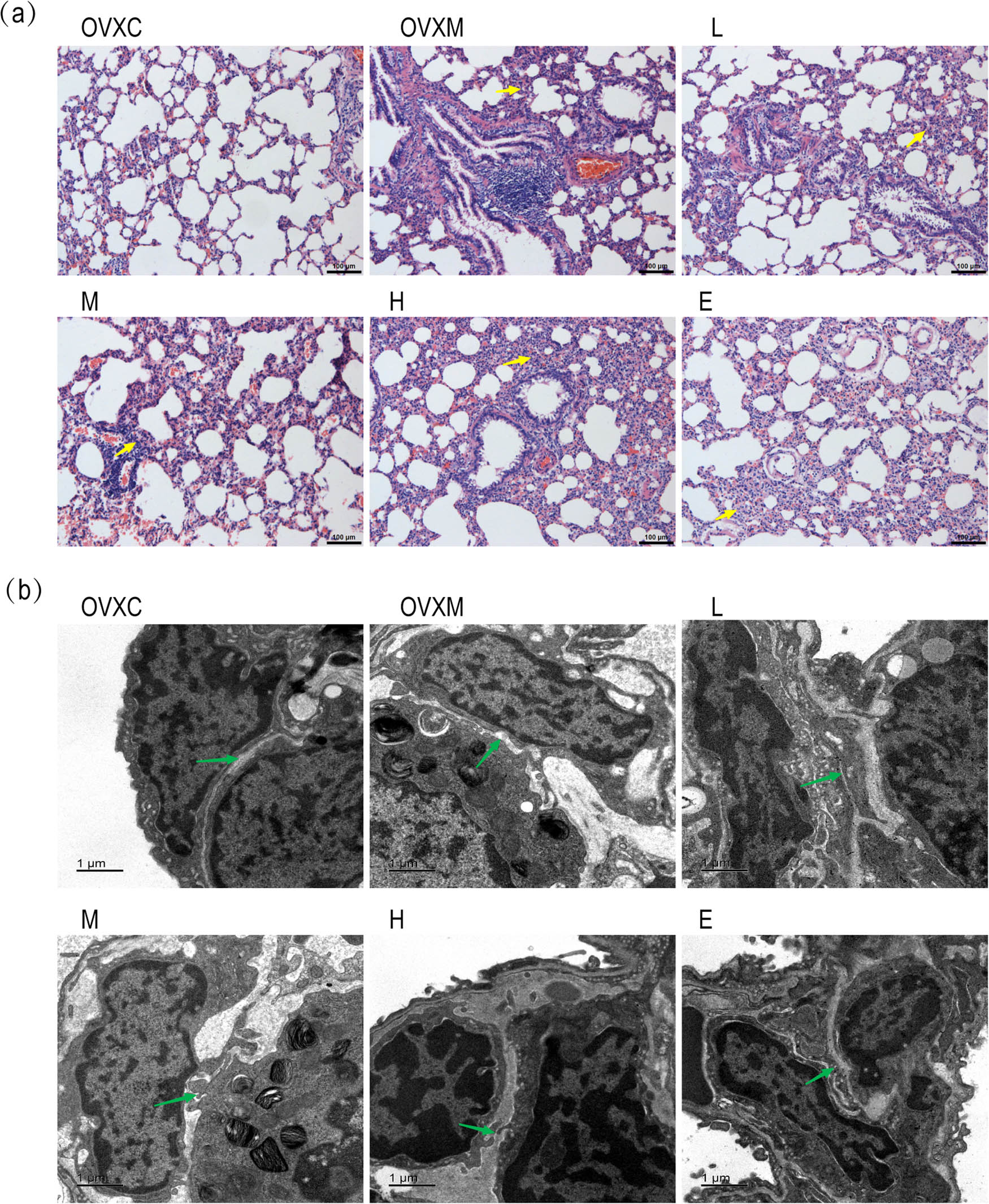 Figure 2
Soy isoflavone reduces the pathological changes of lung tissues. (a) Representative HE staining pictures of lung tissues 6 h after LPS injection in rats, scale bar = 100 μm, the yellow arrow shows the injured site of lung tissue. (b) Electron microscope pictures of lung ultrastructure taken 6 h after LPS treatment, scale bar = 1 μm, and the green arrow shows the intercellular space and swallowing vesicles in the cytoplasm of lung tissues. Data represent mean ± SEM for groups of four rats.