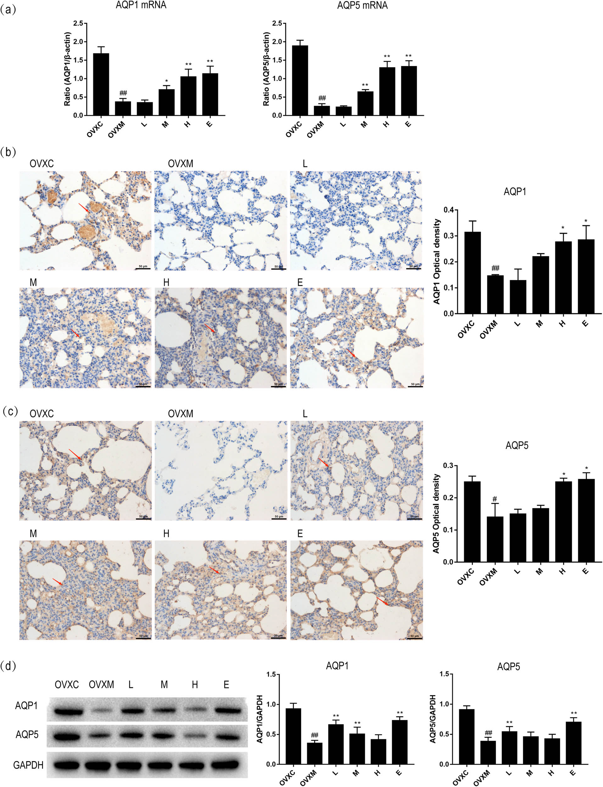 Figure 5
Soy isoflavone increases the mRNA and protein of AQP1 and AQP5 of lung tissues in a dose-dependent manner. (a) Quantitative analysis of AQP1 and AQP5 in lung tissues, n = 6. (b) Representative pictures and quantitative analysis of AQP1 in lung tissues by immunohistochemistry, n = 4, the red arrow shows the expression of AQP1 in lung tissue. (c) Representative pictures and quantitative analysis of AQP5 in lung tissues by immunohistochemistry, n = 4, the red arrow shows the expression of AQP5 in lung tissue. (d) Representative images and quantitative analysis of AQP1 and AQP5 in lung tissues by western blot, n = 6. Data represent mean ± SEM for groups of 4–6 rats, scale bar = 50 μm (#
P < 0.05, ##
P < 0.01 vs OVXC group; *
P < 0.05, **
P < 0.01 vs OVXM group).