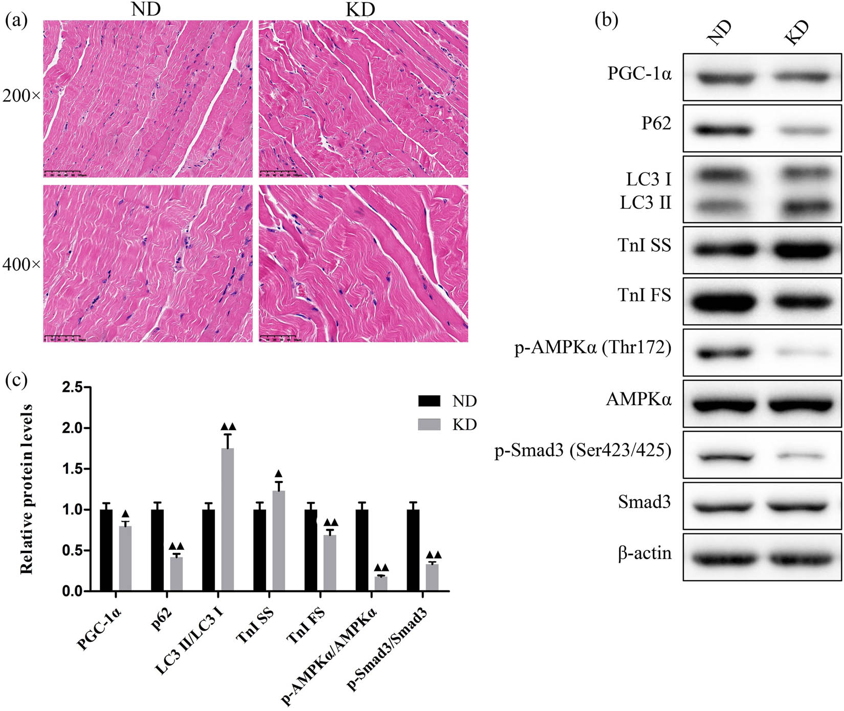 Figure A1 
                  Effect of KD on pathological changes, muscle fiber, and autophagy-related proteins of gastrocnemius tissues in mice. (a) HE staining of the gastrocnemius tissues showed that KD had no differential influence in mice. (b) Representative protein bands and (c) quantification data of PGC-1α, p62, LC3, TnI SS, TnI FS, p-AMPKα, AMPKα, p-Smad3, and Smad3 in gastrocnemius tissues of mice treated with KD for 4 weeks. Data are expressed as mean ± SD. Differences of data in mice were assessed by two-tailed Student’s t-test. ▲
                     P < 0.05, ▲▲
                     P < 0.01 vs ND group. ND, normal diet; KD, ketogenic diet.
               