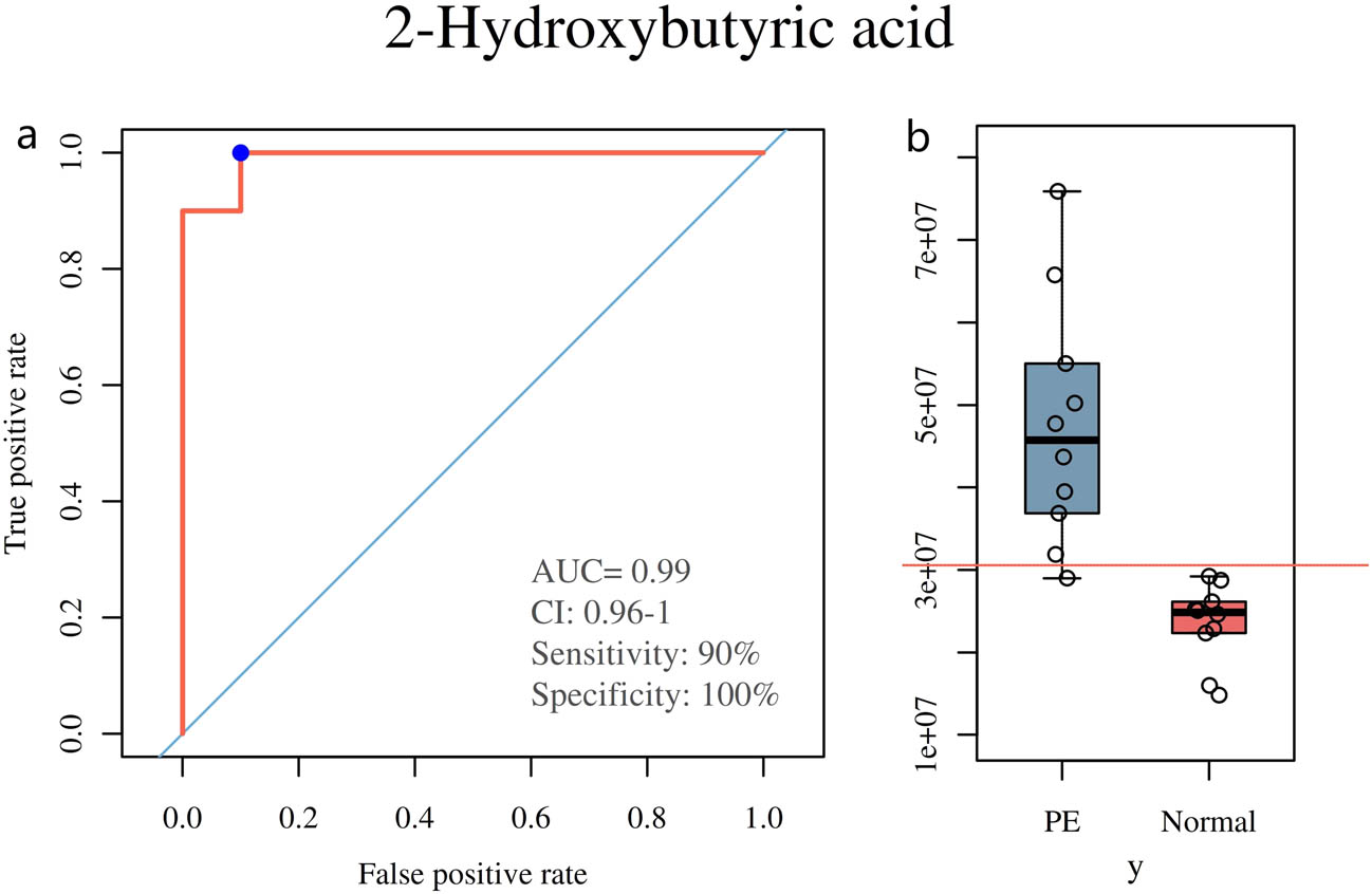 Figure 5 
                  ROC plot of 2-hydroxybutyric acid and the concentrations of 2-hydroxybutyric acid in PE group and normal group. (a) There was an AUC of 0.99. (b) The concentrations of 2-hydroxybutyric acid is 47559849.097 ± 14839964.376 in the PE group and 23509331.240 ± 4802006.390 in the normal group.
               