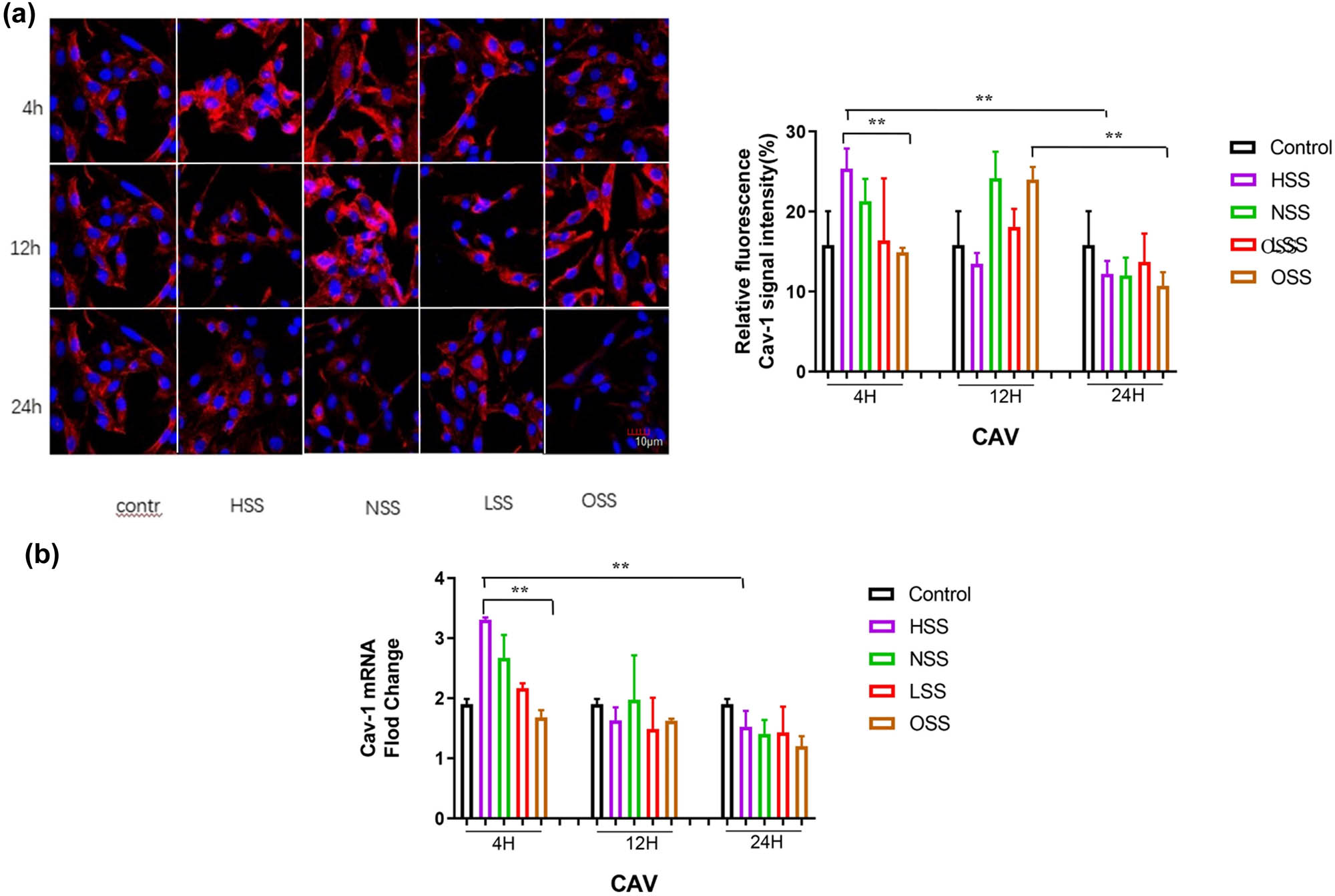 Figure 3 
                  Immunofluorescence staining and RT-qPCR assessing the effect of shear forces on the expression of Cav-1. Red color represents Cav-1 and blue color denotes the controls. (a) Immunofluorescence staining detecting the effect of different shearing forces on Cav-1 expression. The pictures are all enlarged to 600×. (b) RT-PCR evaluating the effect of shearing force on Cav-1 mRNA expression. HSS: high-strength laminar shear force. NSS: normal shear stress. LSS: low-strength laminar shear force. OSS: oscillating shear force. Control: physiological environment. Three independent experiments were done in this study, and triplicates were performed for each group.
               