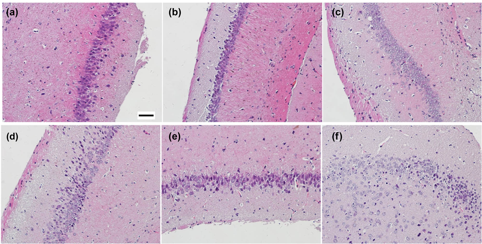Figure 4 
                  Histopathological changes of the hippocampus in epileptic mice. The time-dependent changes of hippocampal neurons at 0 h (a), 3 h (b), 6 h (c), 24 h (d), 3 days (e), and 7 days (f) after the KA injection.
               