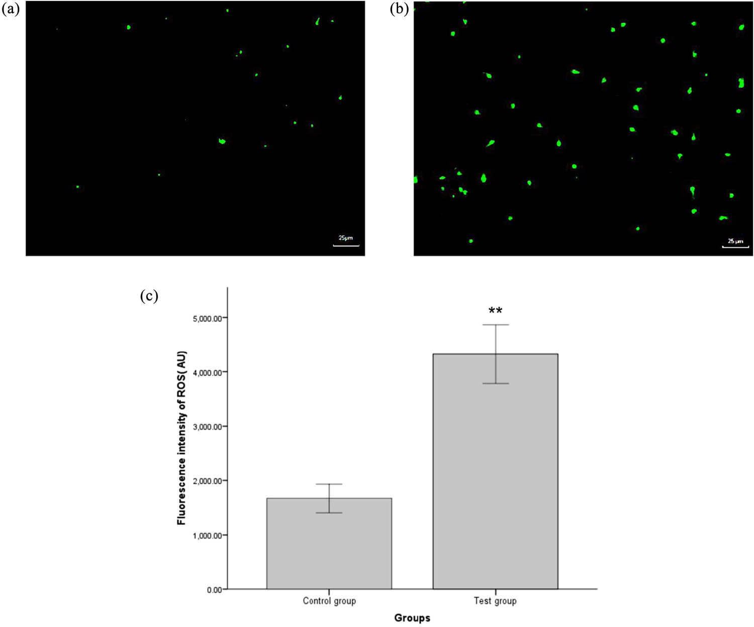 Figure 1 
                  ROS levels of sperm in the control group (a) and test groups (b). ROS production was detected by fluorescence microscopy after DCFH-DA staining; (a and b) (×400). Green staining indicated ROS-positive cells. The fluorescence intensity of ROS in the test group was significantly higher than that in the control group (c). *
                     P < 0.05, **
                     P < 0.01, compared with the control group.
               