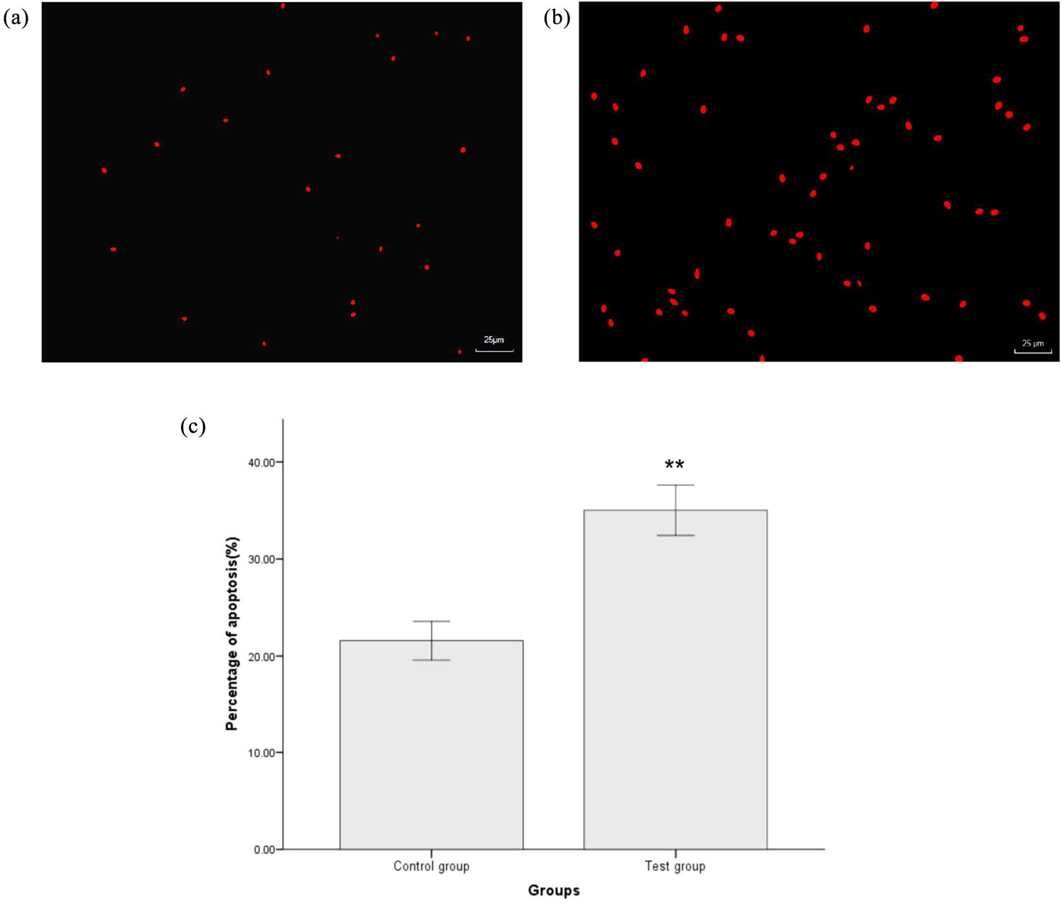 Figure 2 
                  Apoptosis levels of sperm in the control group (a) and test groups (b). ROS production was detected by fluorescence microscopy after AnnexinV-FITC/PI staining; (a and b) (×400). Red staining indicated ROS-positive cells. The percentage of apoptosis in the test group was significantly higher than that in the control group (c). *
                     P < 0.05, **
                     P < 0.01, compared with the control group.
               