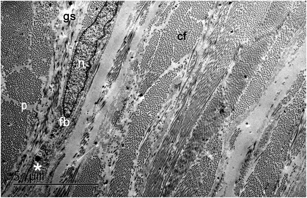 Figure 1 
                  The electron microscopy image of the conjunctiva displays fibroblasts (fb), which are embedded in the interfibrillar matrix (gs: ground substance) and collagen fibril bundles (cf). Fibroblasts display an elliptical nucleus (n) and thin cytoplasmic processes (p), which run parallel to the surface of the eye. Fibroblasts in the conjunctiva contain substantial amounts of rough endoplasmic reticulum (*).
               