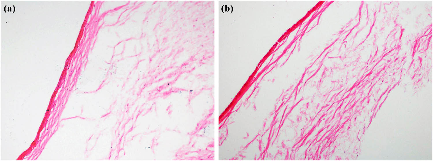 Figure 3 
                  HE staining of conjunctival collagen fibers in control group and treatment group (400×, (a) control group; (b) treatment group).
               