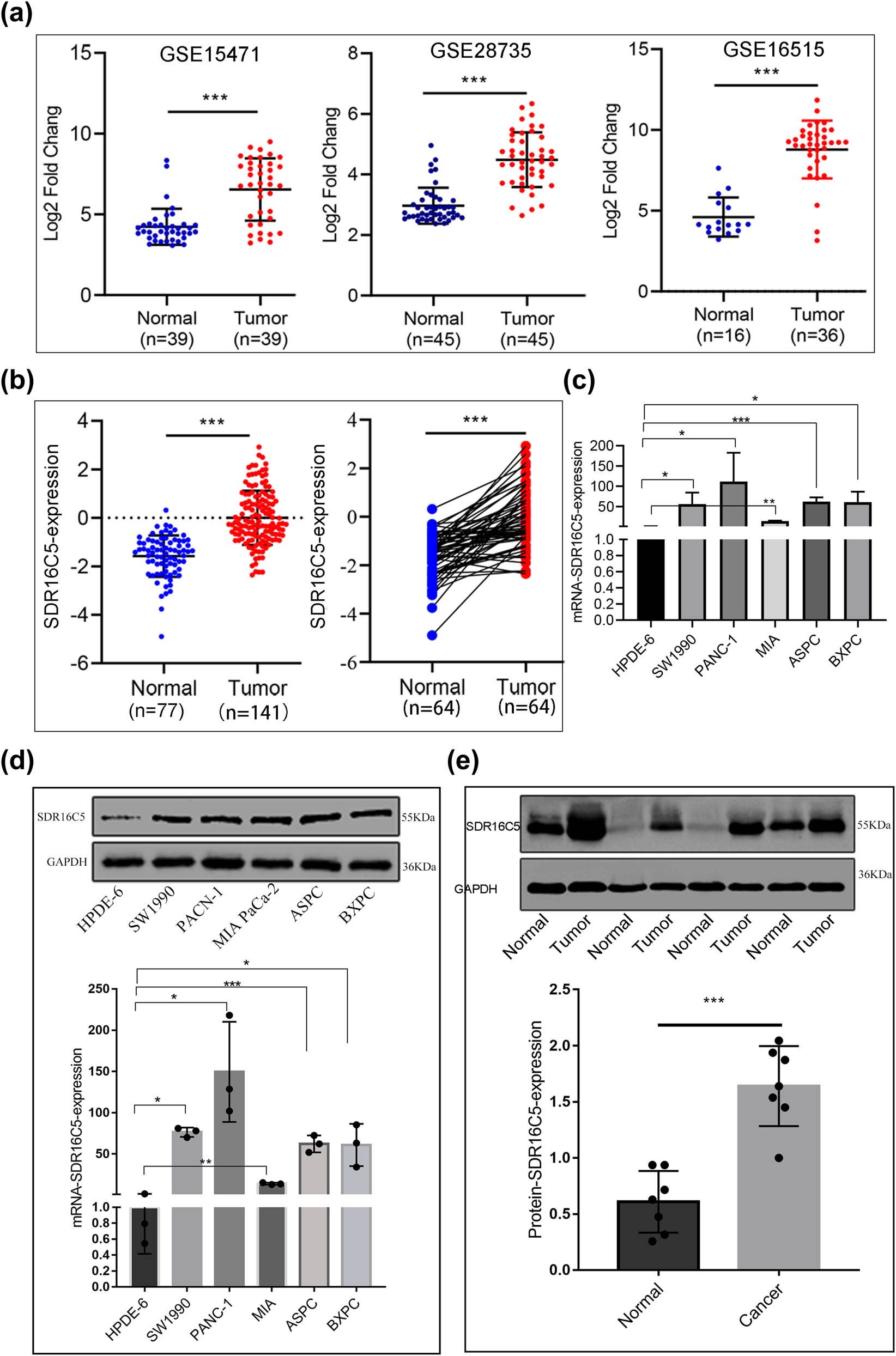 Figure 7 
                  SDR16C5 was highly upregulated in PAAD tissues and cell lines. (a) The expression of SDR16C5 in the GEO data: GSE15471 (N = 36, T = 36), GSE28735 (N = 45, T = 45), GSE16515 (N = 16, T = 36). (b) SDR16C5 protein expression in PAAD: samples containing cancerous tissues and paired adjacent noncancerous samples were screened out in CPTAC data. (c) qRT-PCR analysis of SDR16C5 in different cell lines of PAAD. (d) Western blot analysis of the expression of SDR16C5 in different cell lines of PAAD. (e) Western blot analysis of SDR16C5 in PAAD tissues and adjacent tissues. Experiments were repeated three times with three replicates of each sample. ns, P > 0.05; *P < 0.05; **P < 0.01; ***P < 0.001.
               