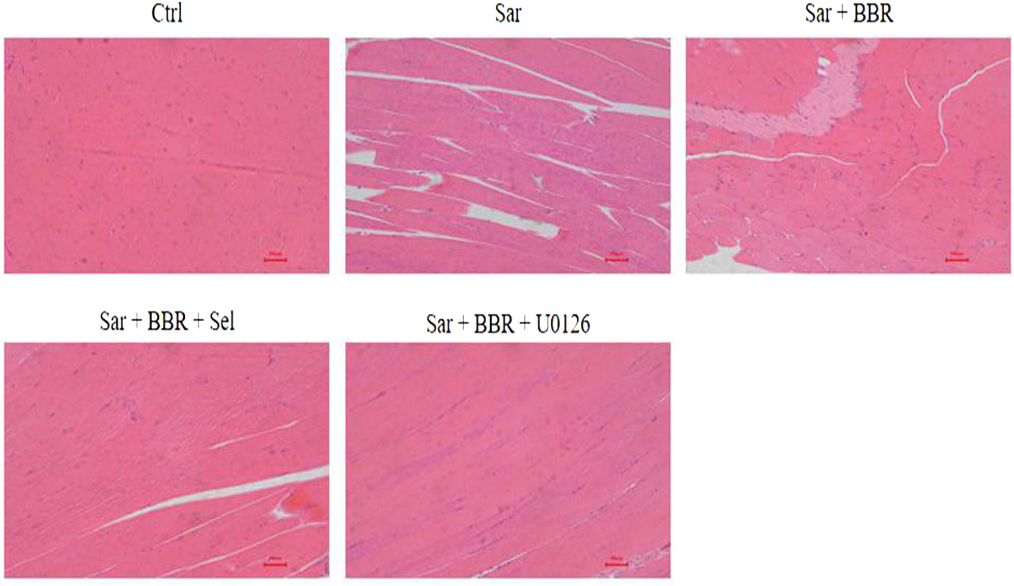 Figure 2 
                  Muscle tissue significantly increased after treatment with berberine. Gastrocnemius tissue was observed by HE staining. Scale bar, 10 µm. Representative results were performed from independent experiments (n  = 5).
               