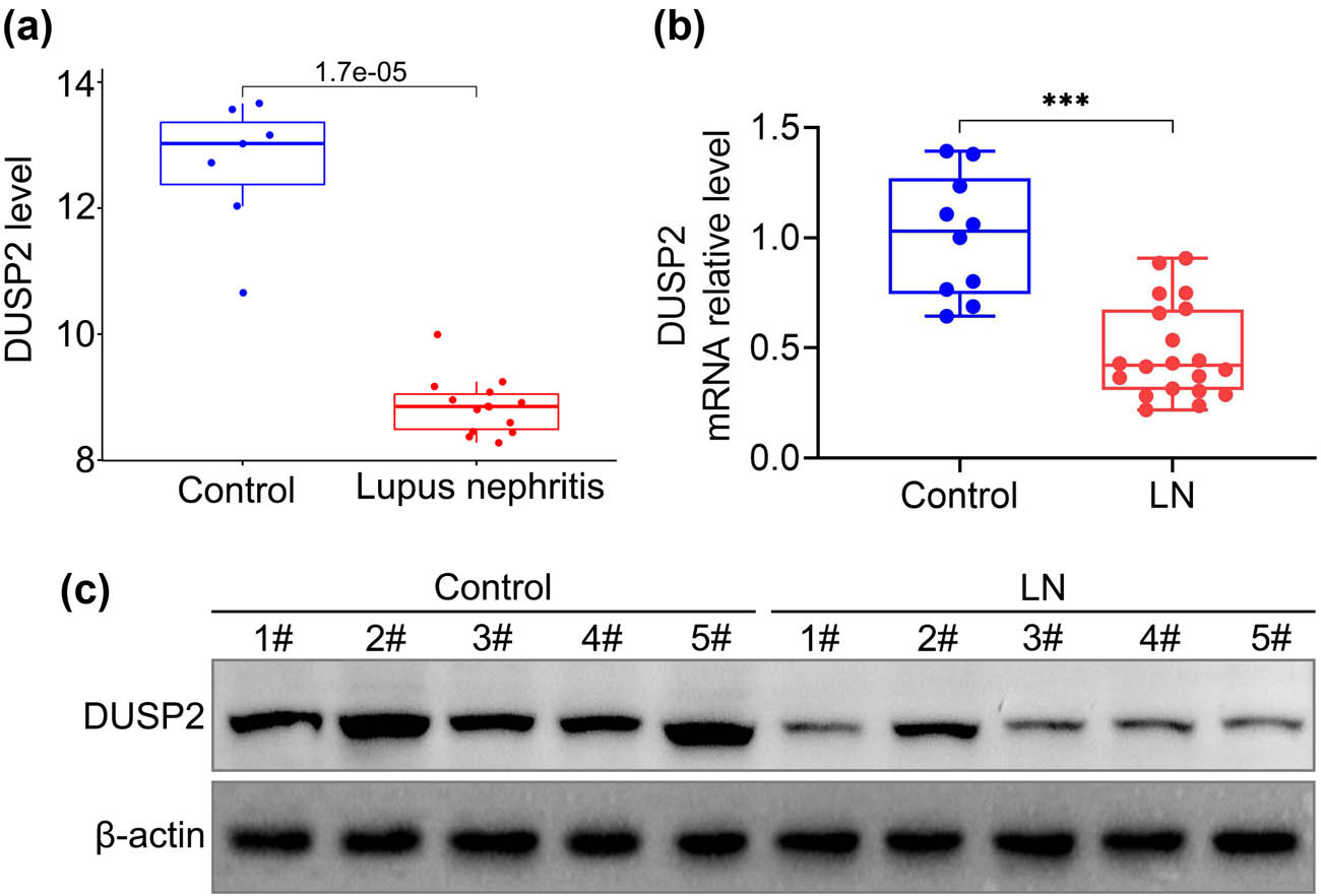 Figure 1
Low expression of DUSP2 in LN. (a) Expression of DUSP2 in normal and LN kidney tissues obtained from GSE112943 expression profile. (b) The mRNA expression levels of DUSP2 in normal and LN kidney tissues. (c) Protein expression levels of DUSP2 in normal and LN renal tissues. ***
P < 0.001 vs control.