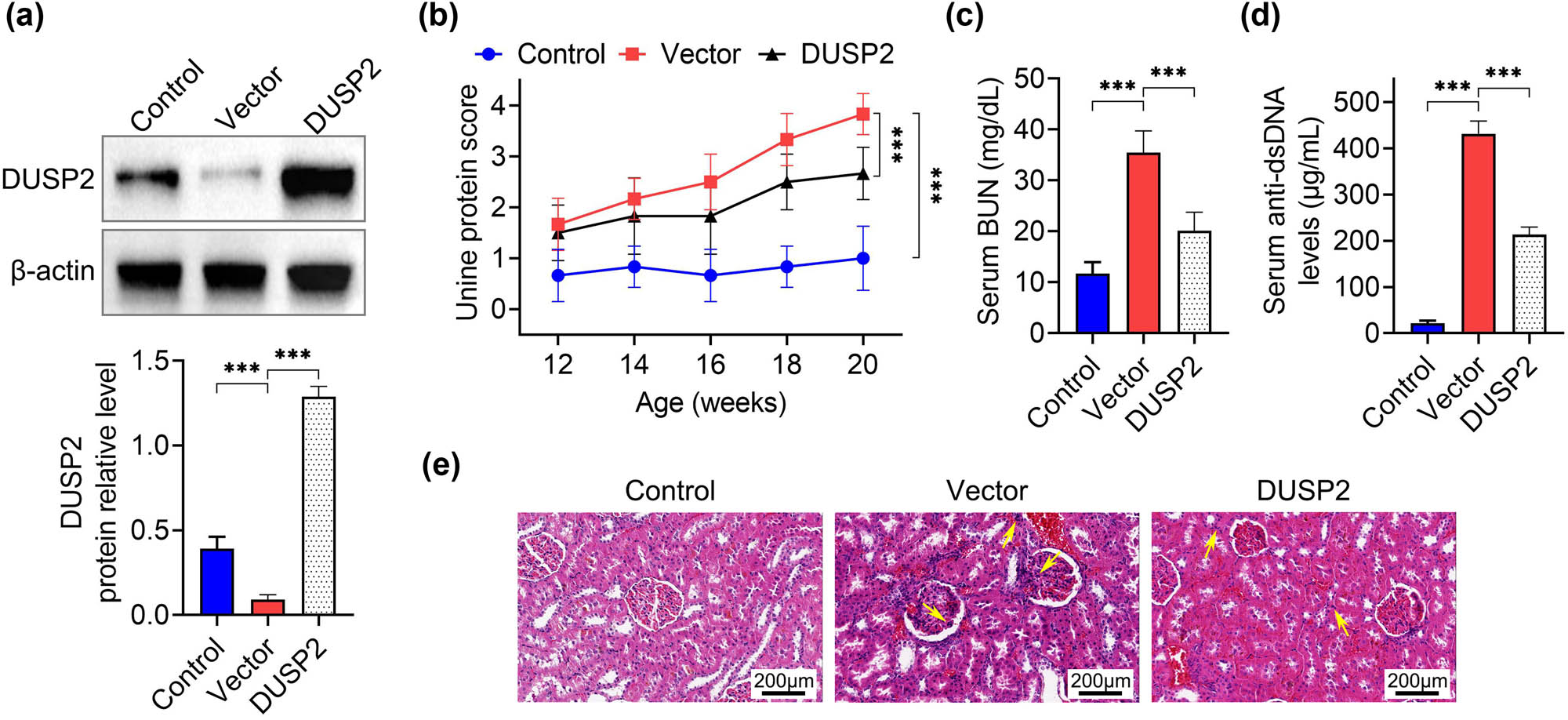 Figure 2
DUSP2 ameliorates renal tissue lesions in mice with LN. (a) Expression levels of DUSP2 protein in kidney tissues of various groups of mice. (b) Changes in proteinuria levels of mice in each group from 12 to 20 weeks. (c) Serum urea nitrogen levels in all groups of mice. (d) Serum dsDNA levels in each group of mice. (e) Renal histopathology of mice in each group ***
P < 0.001 vs vector.
