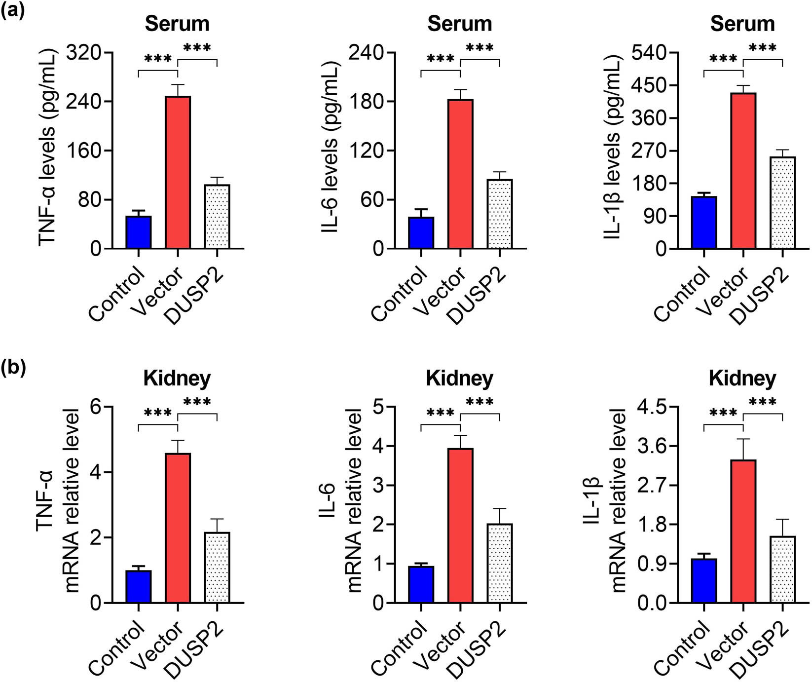 Figure 3
DUSP2 reduces kidney tissue inflammation in mice with LN. (a) Serum TNF-α, IL-6, IL-1β content of mice in each group. (b) Expression of TNF-α, IL-6, IL-1β mRNA in kidney tissue of mice in each group. ***
P < 0.001 vs vector.
