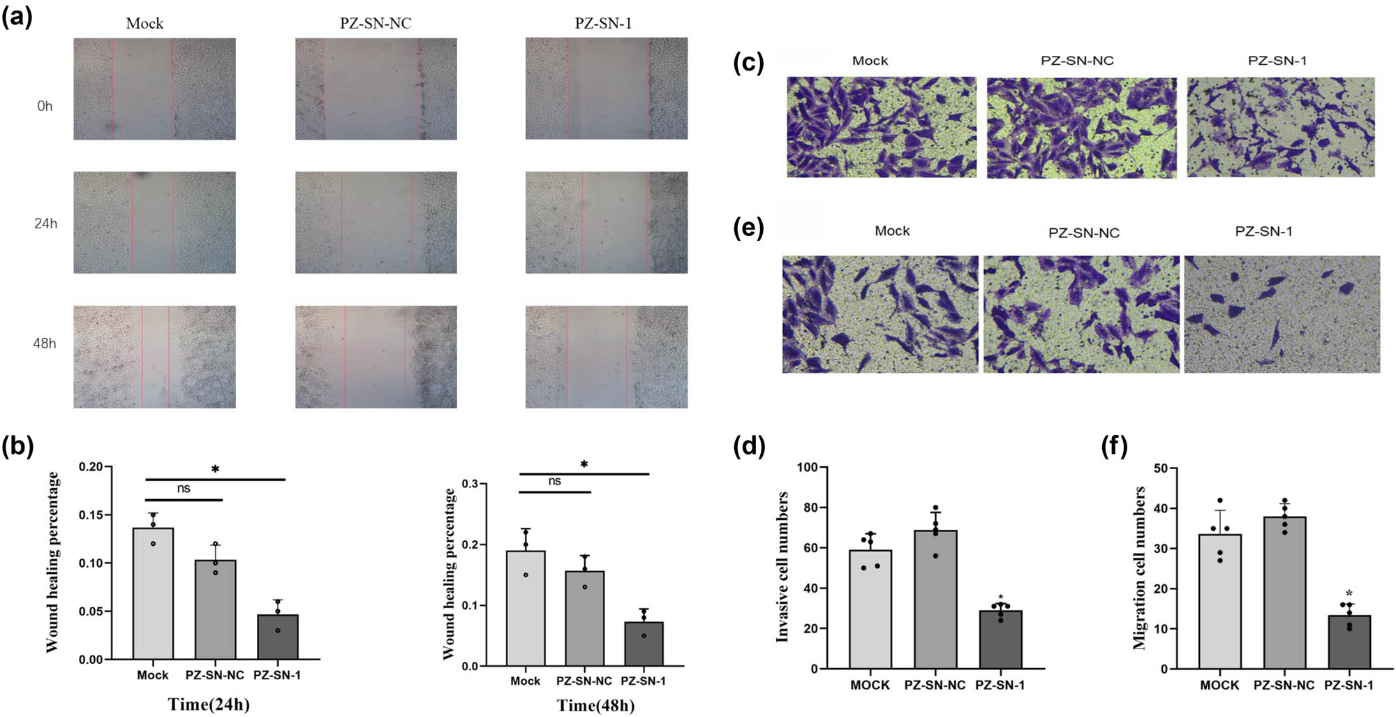 Figure 3 
                  Impact of PZ knocking-down on cellular migration and invasion in A549 cells. (a) Cellular migration is detected in wound healing assay in the mock (left column), PZ-siRNA-01 (right column), and siRNA-NC (middle column) A549 cells for 24 h (middle panels) and 48 h (lower panels). 0 h represents the begging time of the assays. (b) The average cellular migration rates of the corresponding samples in A are estimated from three independent assays. (c) Cellular invasion assay is conducted with the Transwell method in the mock (left), PZ-siRNA-1 (right, PZ-SN-1), and siRNA-NC (middle, PZ-SN-NC) A549 cells. (d) Average cellular invasion rates of the corresponding samples in C are calculated from three independent assays. (e) Cellular migration assay is performed in the indicated samples. (f) Average cellular migration rates of the samples in E are analyzed from three independent assays. * indicates the significant difference between the groups (p < 0.05).
               