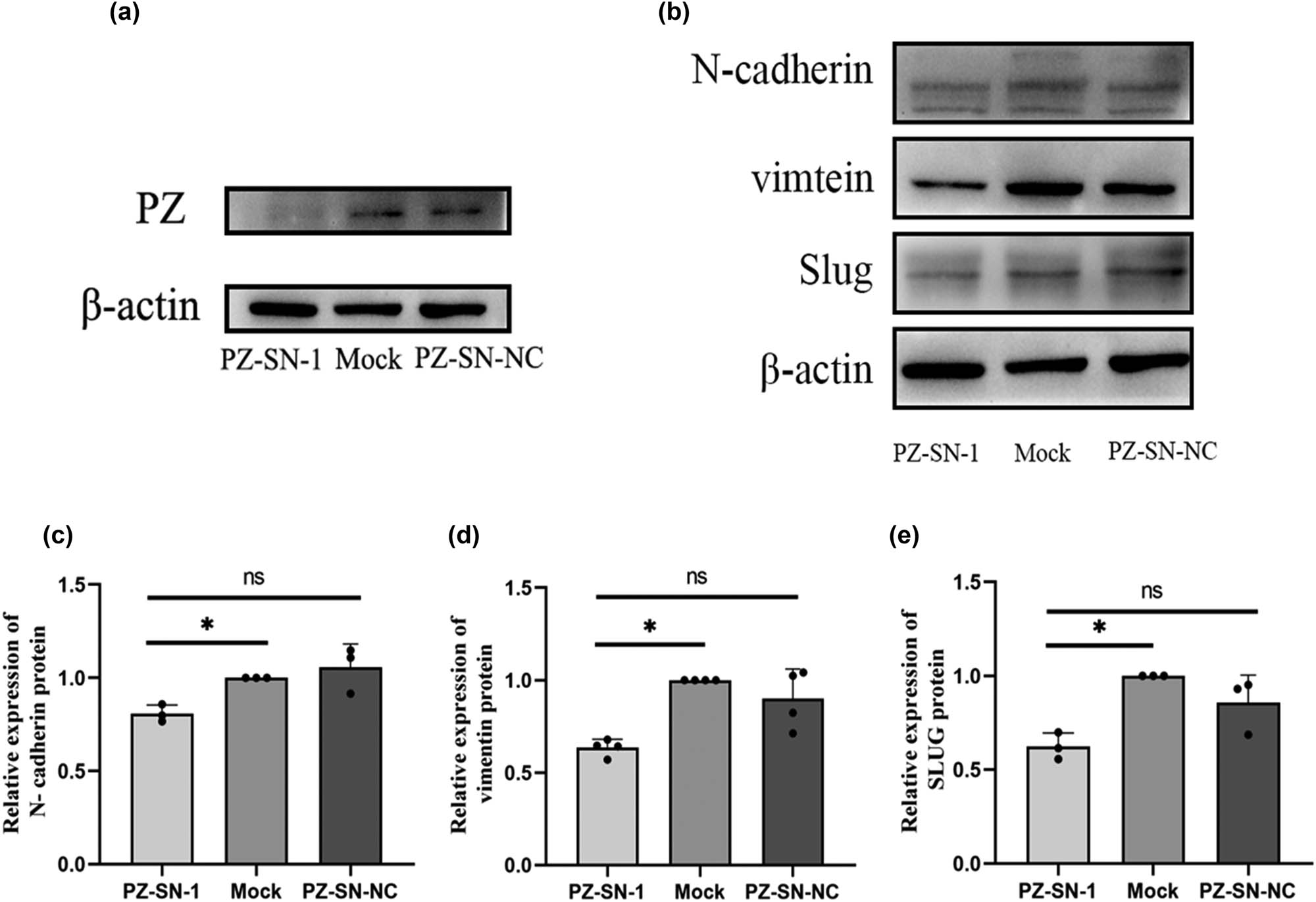 Figure 5 
                  Effect of PZ knocking-down on epithelial–mesenchymal transition (EMT)-related proteins (Slug, Vimentin, and N-cadherin) expression in A549 cells. (a) Representative images of the Western blot shows the PZ (upper panel) expression in the PZ-siRNA-001 (left), mock (middle), and siRNA-NC (right) A549 cells. (b) The protein expression of N-cadherin (upper panel), Vimentin (second panel), and Slug (third panel) are examined by Western blot in the PZ-siRNA-1 (left), mock (middle), and siRNA-NC (right) cells. The average expression levels of N-cadherin (c), Vimentin (d), and Slug (e) in the corresponding cells are evaluated from three independent assays. * indicates the significant difference between the groups (p < 0.05).
               