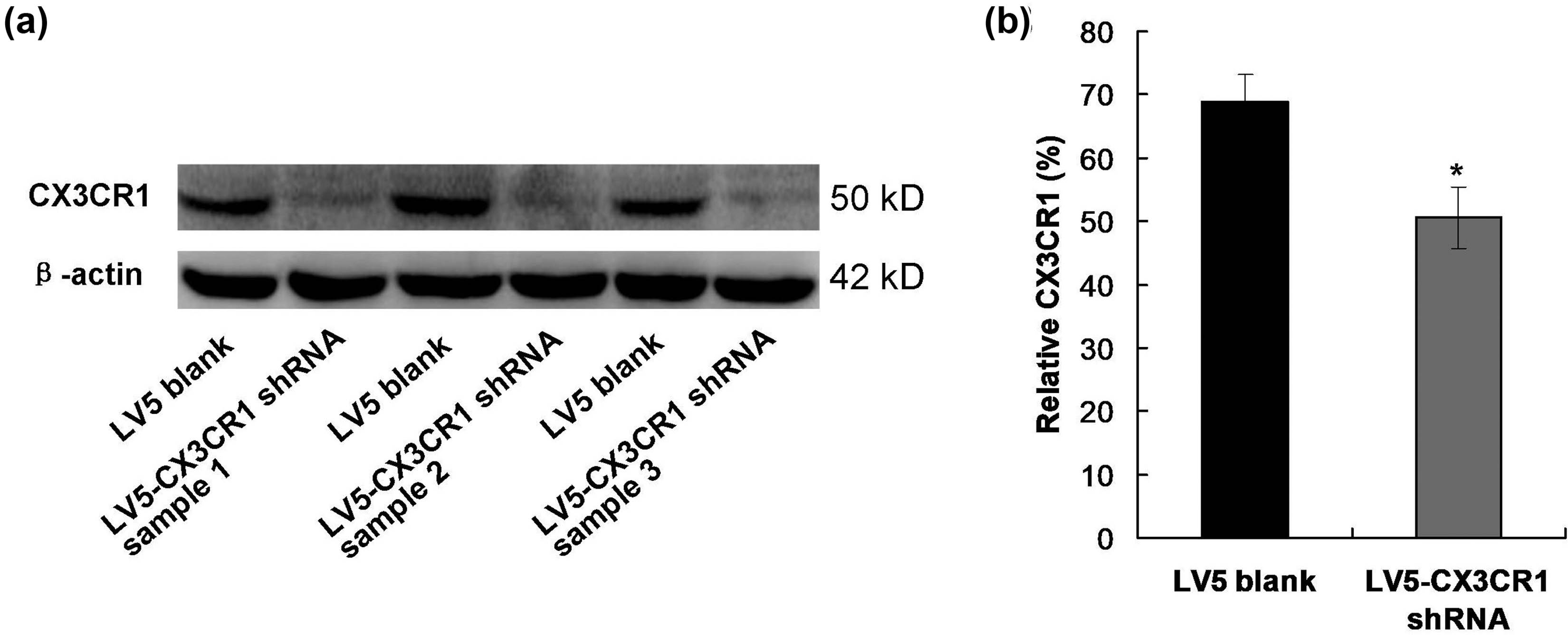 Figure 3
Determination for the interfering efficacy of CX3CR1 shRNA samples. (a) Western blot image. (b) Statistical for the relative expression of CX3CR1. CX3CR1: CX3C chemokine receptor 1.