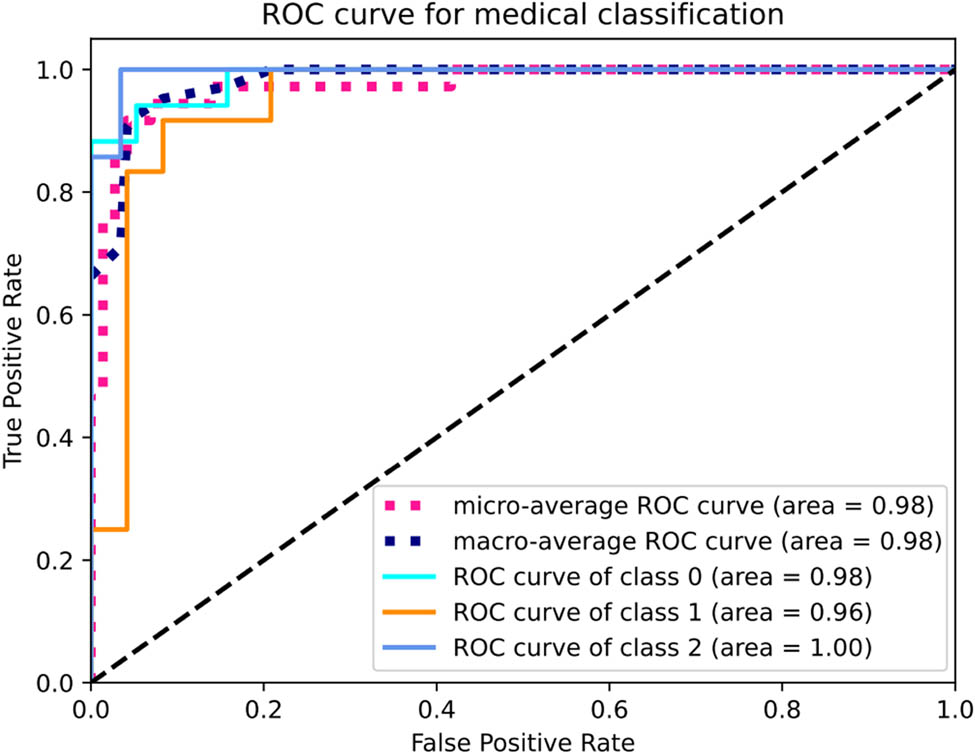 Figure 21 
               Multi-class ROC curve.
            