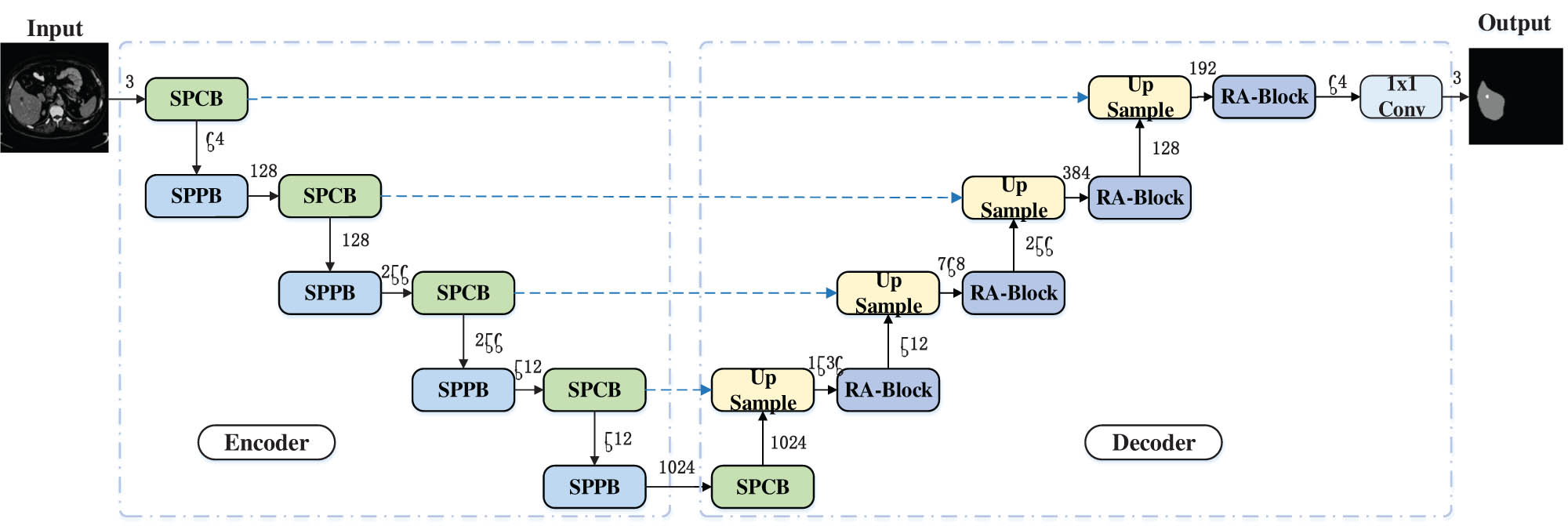 Figure 1 
                  SPA-UNet architecture.
               