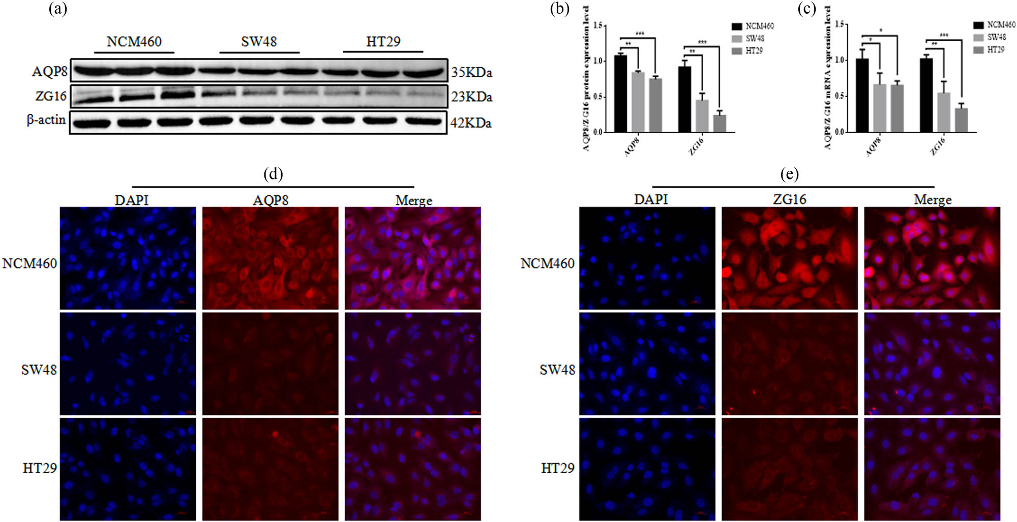 Figure 7 
                  AQP8 and ZG16 in colon cancer cells. (a) and (b) The protein expression levels of AQP8 and ZG16 were determined by Western blotting. (c) The mRNA expression levels of AQP8 and ZG16 were determined by qRT-PCR. (d) and (e) Cellular immunohistochemical staining.
               