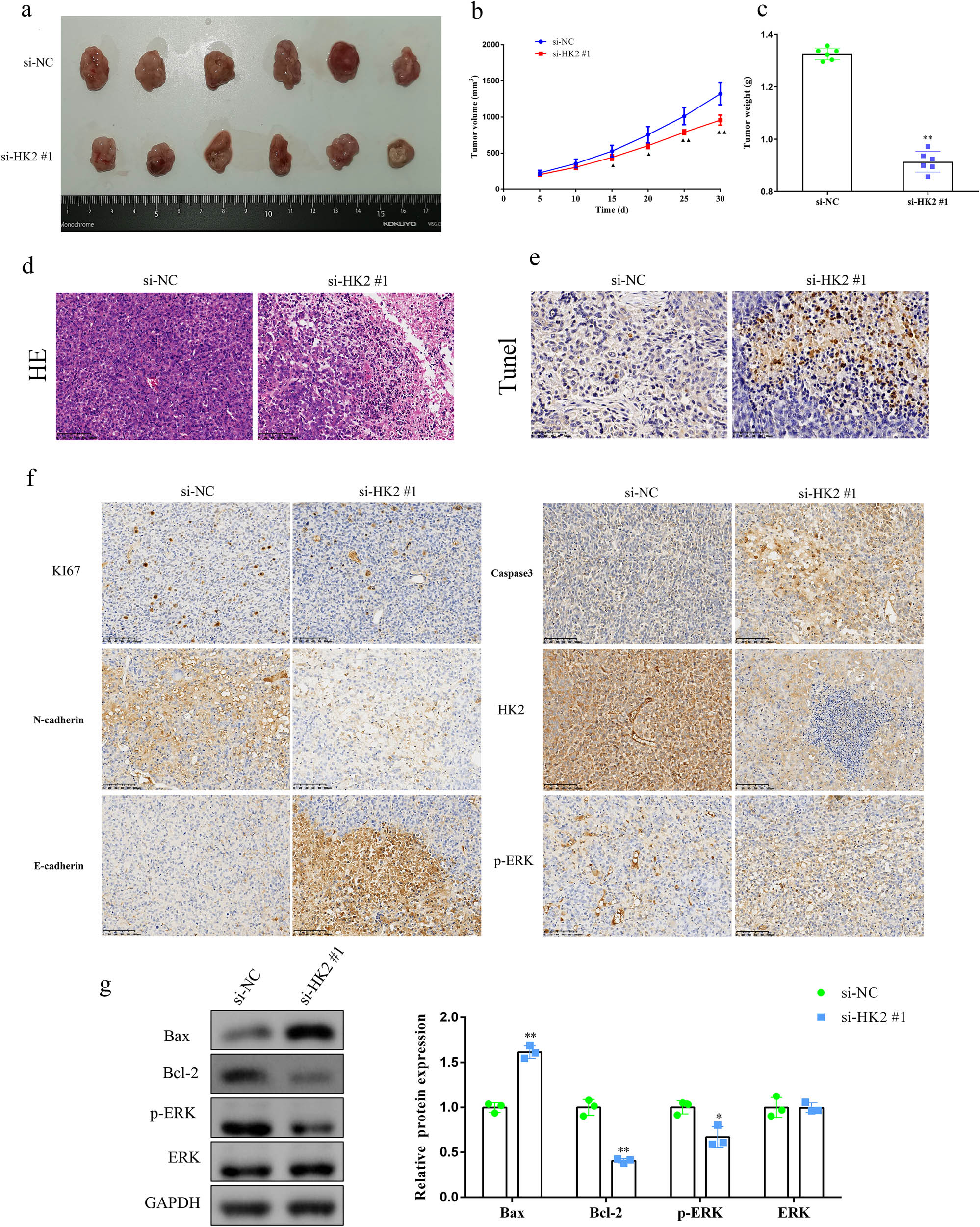 Figure 5 
                  HK2 knockdown suppresses DLBCL tumor growth in vivo. (a) Representation of tumor tissues of the xenograft in nude mice. (b) The tumor growth rate and (c) weight were markedly decreased in HK2-knockdown cell-treated nude mice. (d) Pathologic changes and (e) apoptosis of tumor tissues were measured with hematoxylin and eosin staining (scale bar = 100 μm) and TUNEL assay (scale bar = 50 μm), respectively. (f) Ki67, caspase 3, N-cadherin, HK-2, E-cadherin, and p-ERK expression in the xenografts was measured using IHC staining (scale bar = 100 μm). (g) Expression levels of Bax, Bcl-2, p-ERK, and ERK were measured using Western blotting. *P < 0.05 and **P < 0.01 versus the si-NC group.
               