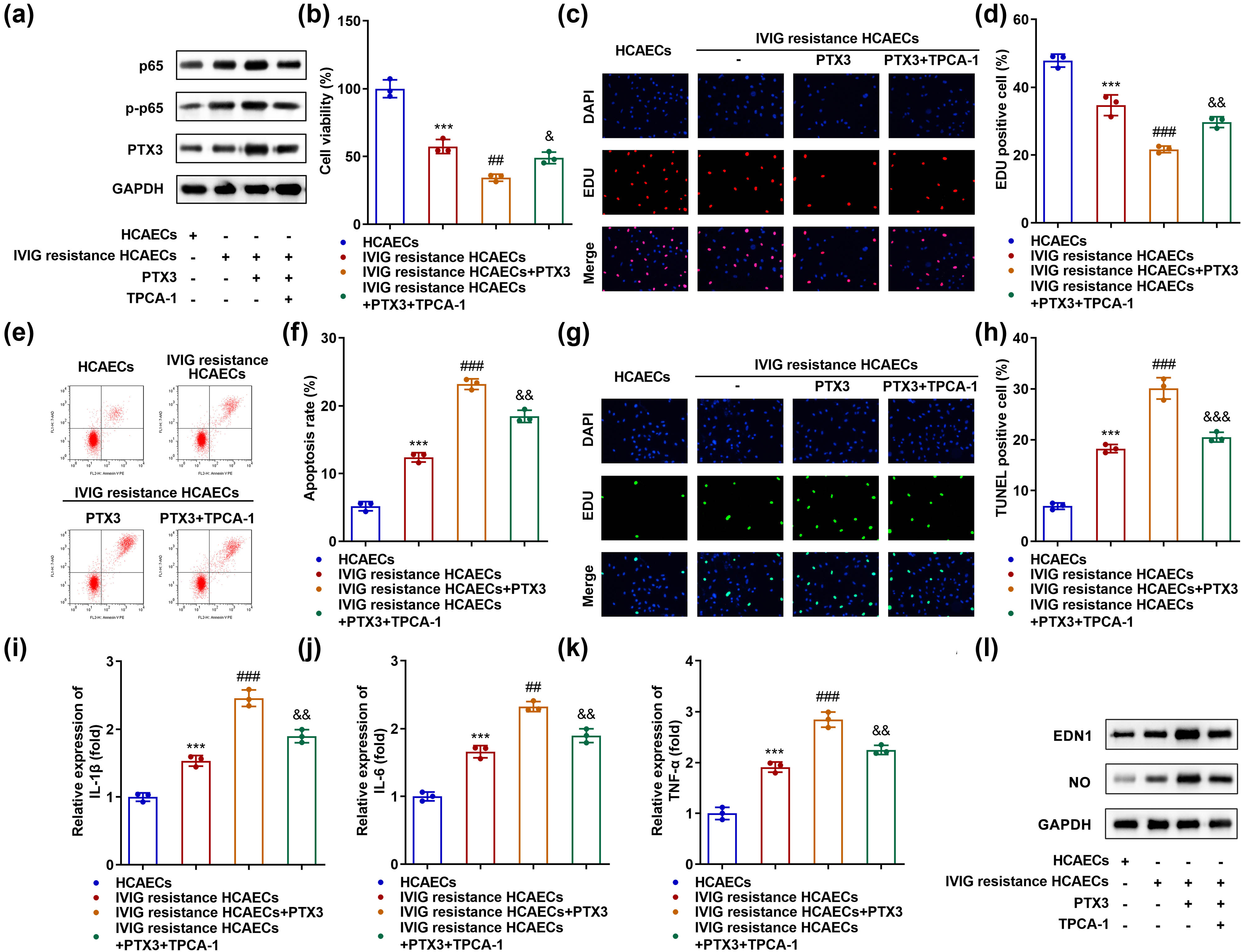 Figure 5 
                  PTX3 promotes IVIG resistance-induced endothelial injury by regulating the NF-κB pathway. (a) Protein expression of p65, p-p65, and PTX3 was measured using western blotting. (b) CCK-8 and (c and d) EdU assays were used to evaluate cell proliferation. (e and f) Flow cytometry and (g and h) TUNEL analysis evaluated apoptosis. qRT-PCR measured the levels of inflammatory factors (i) IL-1β, (j) IL-6, and (k) TNF-α. (l) Western blotting was performed to measure the protein levels of EDN1 and NO. ***P < 0.001, ##
                     P < 0.01, and ###
                     P < 0.001. &
                     P < 0.05, &&
                     P < 0.01, and &&&
                     P < 0.001.
               