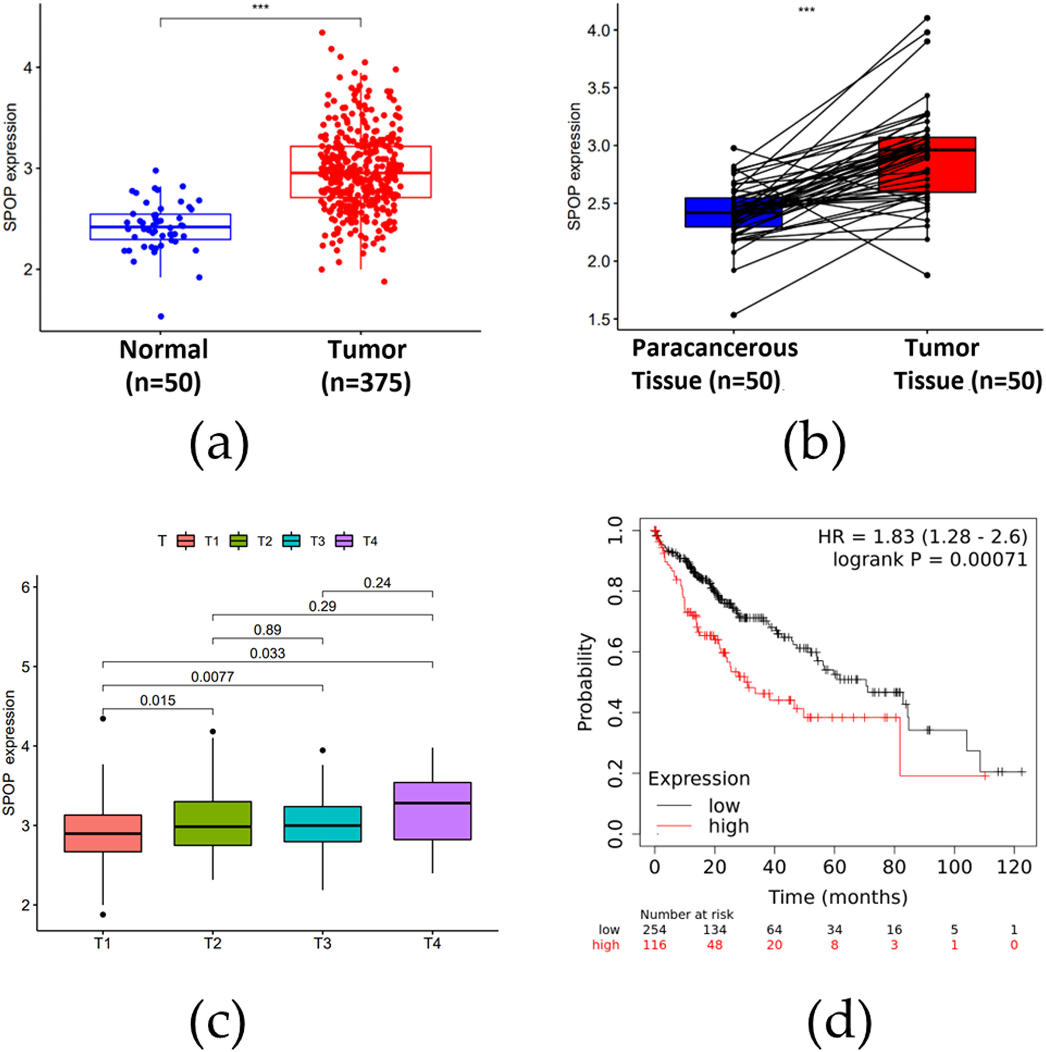 Figure 5
Results of bioinformatics analysis of SPOP in HCC. (a) Differential expression of SPOP in HCC tissues and normal liver tissues. (b) Differential expression of SPOP in paraneoplastic and HCC tissues. (c) Correlation of SPOP expression with tumor stage. (d) Analysis of overall survival of SPOP expression in HCC patients.