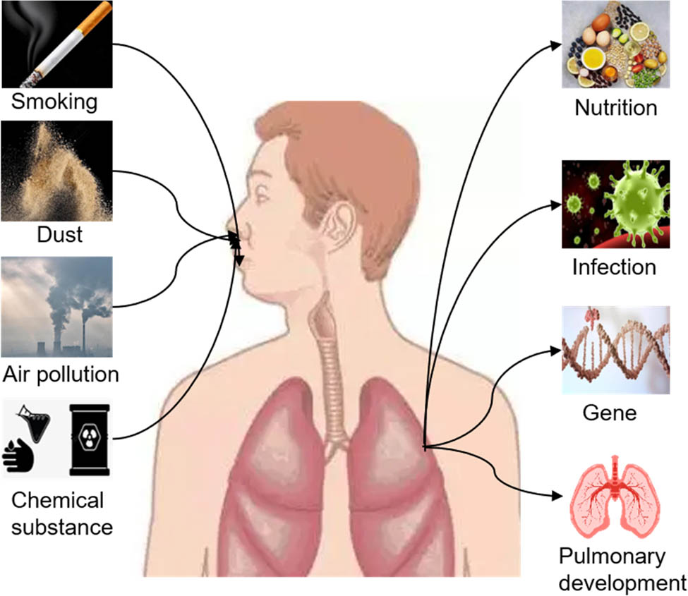 Figure 3 
                  Risk factors of COPD.
               