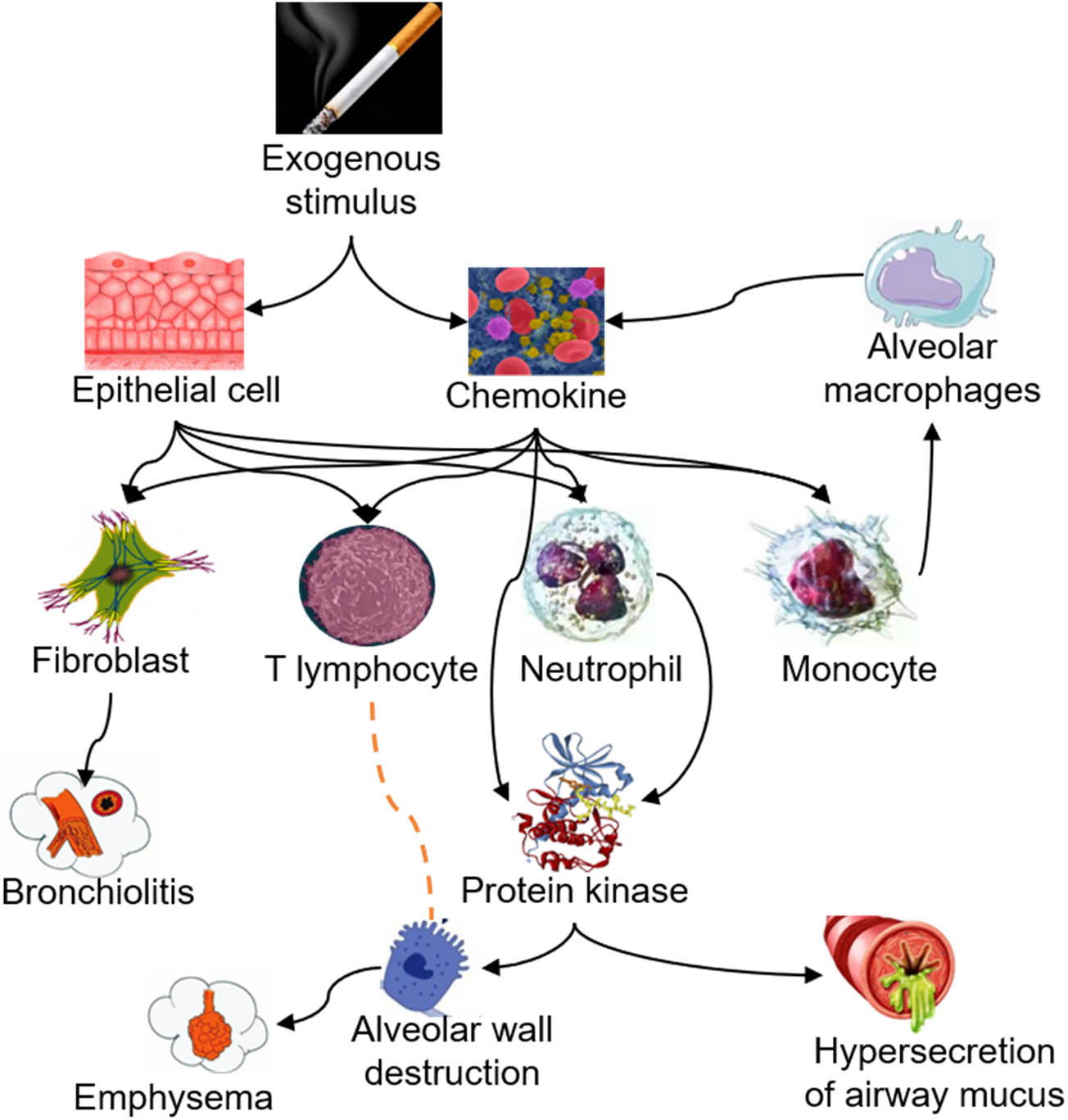 Figure 4 
                  Pathogenesis of COPD [34].
               