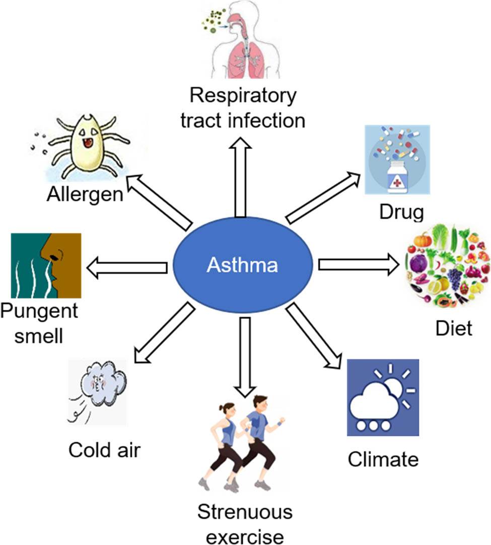 Figure 7 
                  Environmental factors of asthma onset.
               