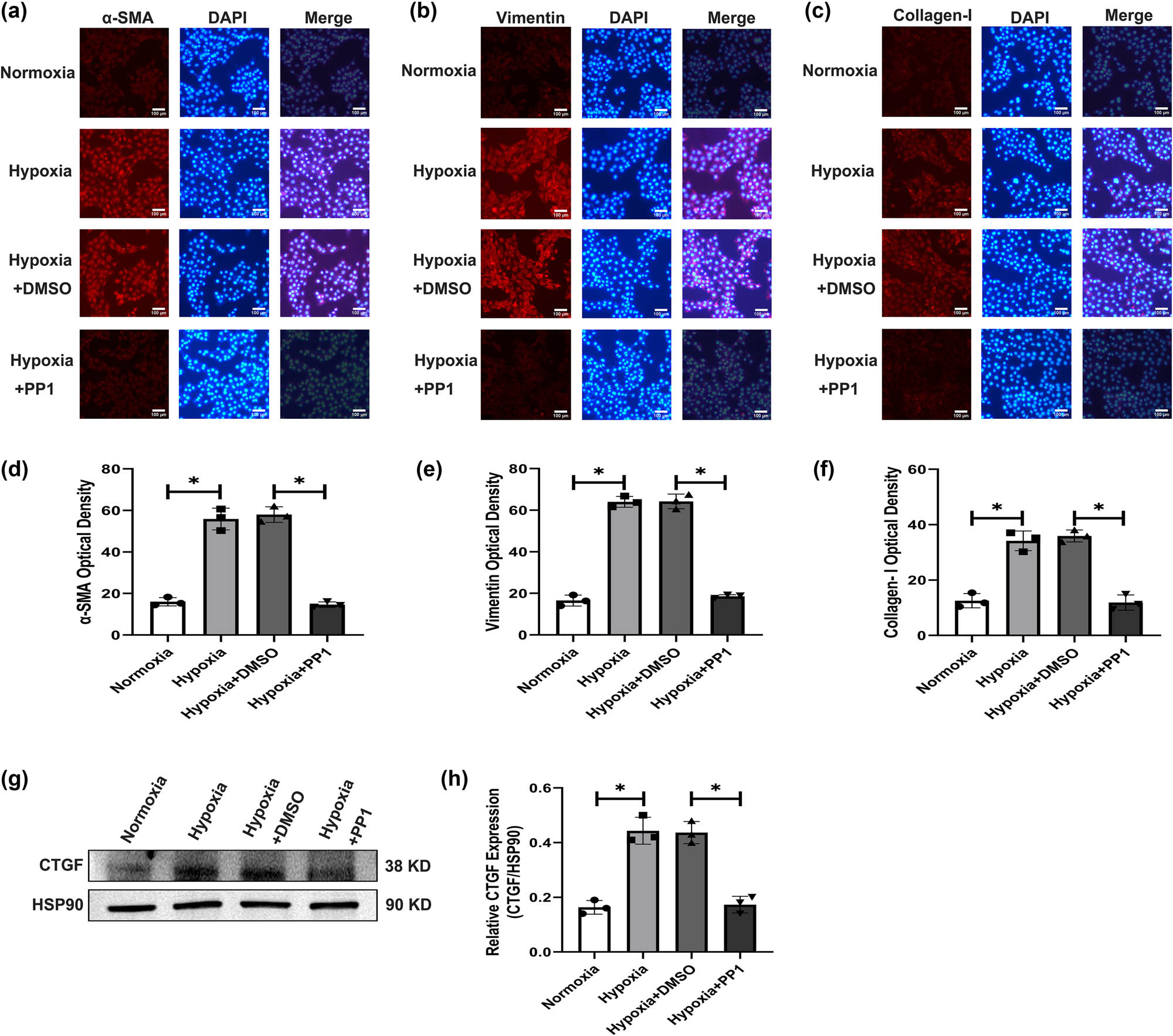 Figure 2 
                     Expression of activation-related markers in HSC-T6 cells under different culture conditions. (a) α-SMA expression. (b) Vimentin expression. (c) Collagen-I expression. (d–f) Relative expression of α-SMA, Vimentin, and Collagen-I in each group, *P < 0.05. (g) Protein levels of CTGF. (h) Relative expression of CTGF in each group, *P < 0.05.
                  