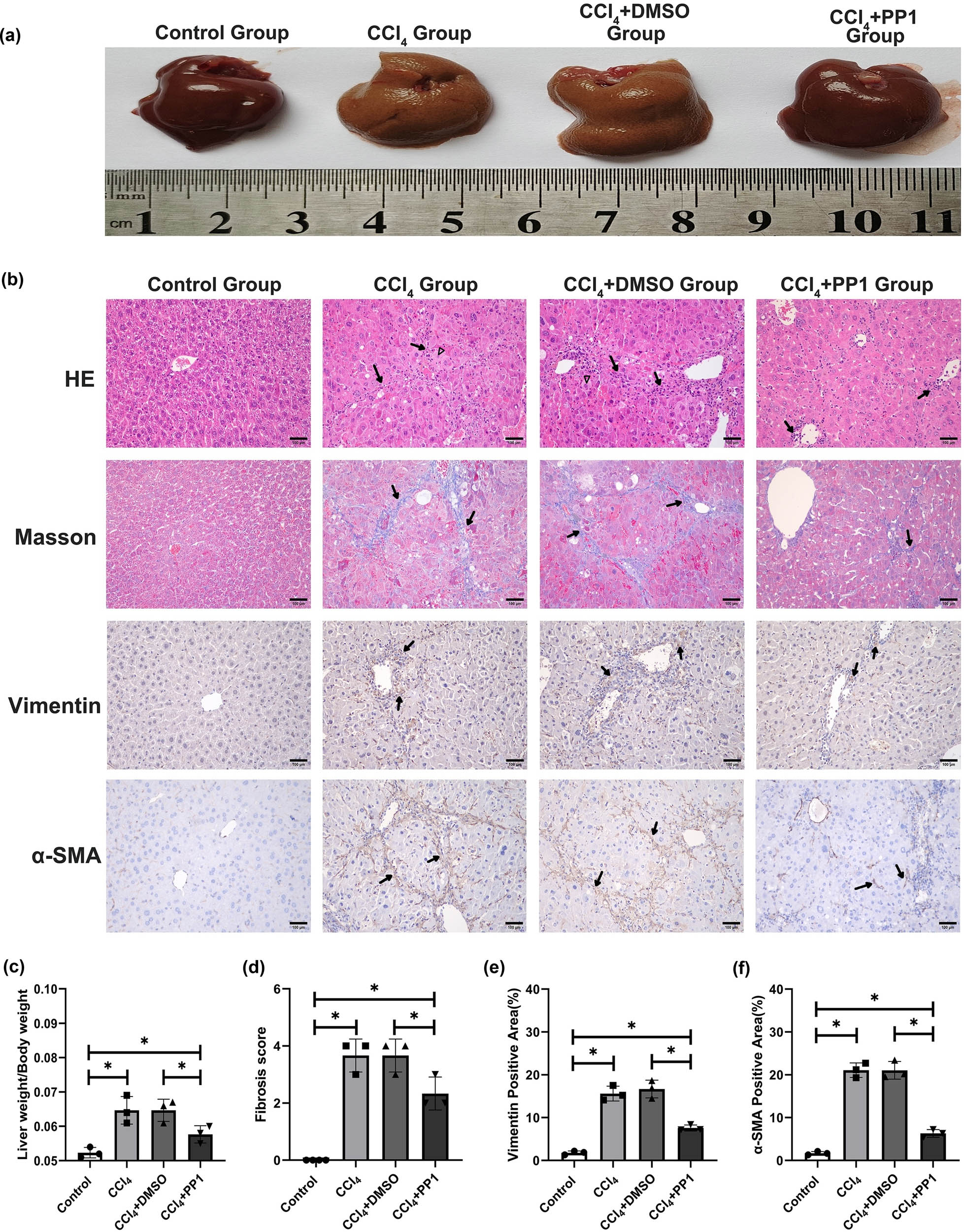 Figure 4 
                  Liver gross morphology, HE and Masson staining, immunostaining of Vimentin and α-SMA, the liver weight/body weight ratio, and fibrosis score in the different groups. (a) Liver gross morphology. (b) HE, Masson staining, and immunostaining of Vimentin and α-SMA. HE, arrows denote inflammatory cell infiltration and triangle symbol denotes hepatocyte edema; Masson, arrows denote collagen deposition; Vimentin, arrows denote Vimentin positivity; α-SMA, arrows denote α-SMA positivity. (c) Liver weight/body weight ratio, * P < 0.05. (d) Fibrosis score, * P < 0.05. (e) Vimentin-positive area, * P < 0.05. (f) α-SMA-positive area, * P < 0.05.
               