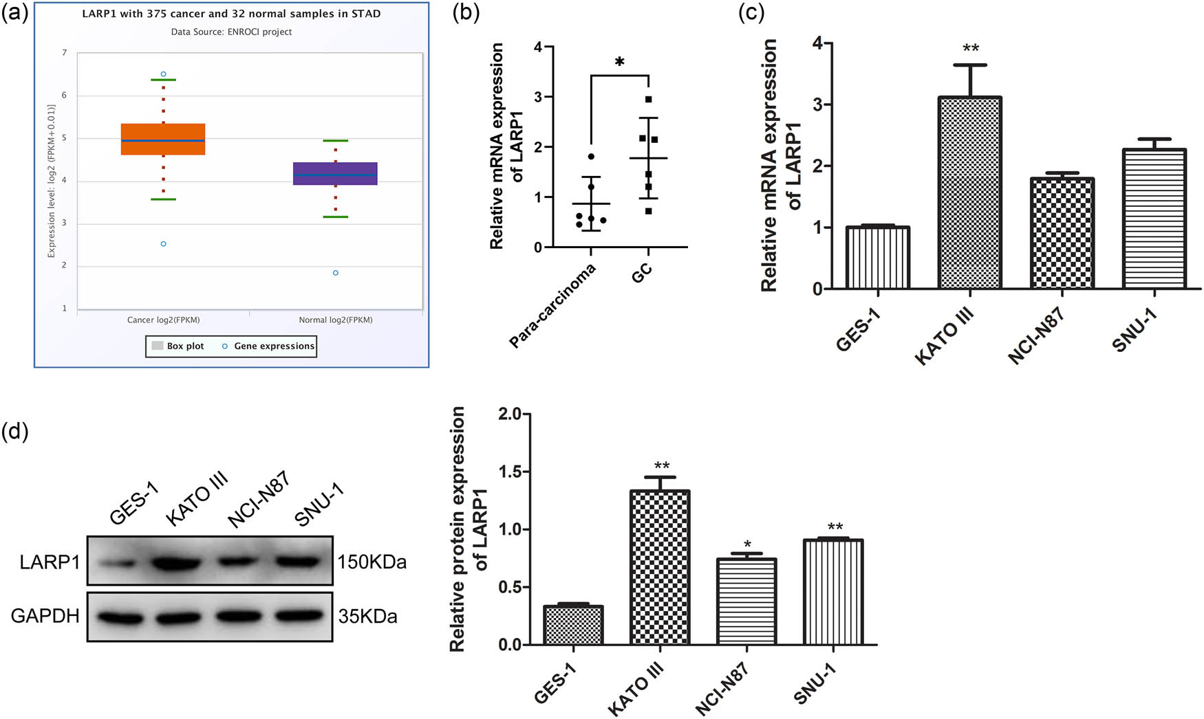 Figure 1
LARP1 expression level in clinical GC tissues and GC cell lines. (a) mRNA expression levels of LAPR1 in stomach cancer (STAD) and normal samples were searched in the ENCORI platform. (b) LARP1 level was compared between six pairs of GC tissues and para-carcinoma tissues using qRT-PCR. (c) The mRNA expression of LARP1 was compared between a normal gastric mucosa cell line (GES-1) and three GC cell lines (KATO III, NCI-N87, and SNU-1). (d) The protein expression of LARP1 was compared between GES-1 and three GC cell lines (KATO III, NCI-N87, and SNU-1) using a western blot. *P < 0.05, **P < 0.01 compared with para-carcinoma tissue or GES-1.