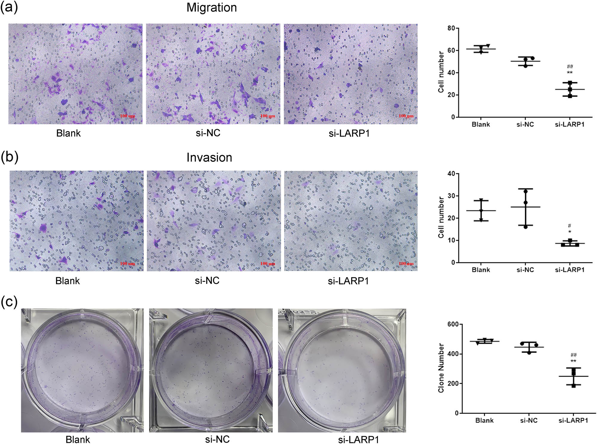 Figure 3
LARP1 knockdown inhibits GC cell migration, invasion, and colony formation. Transwell migration assay (a) and transwell invasion assay (b) were used to detect cell metastasis ability in si-LARP1-transfected KATO III cells. (c) Colony formation assay was used to evaluate cell growth in si-LARP1-transfected KATO III cells. *P < 0.05, **P < 0.01 compared with the blank group. #
P < 0.05, ##
P < 0.01 compared with the si-NC group.