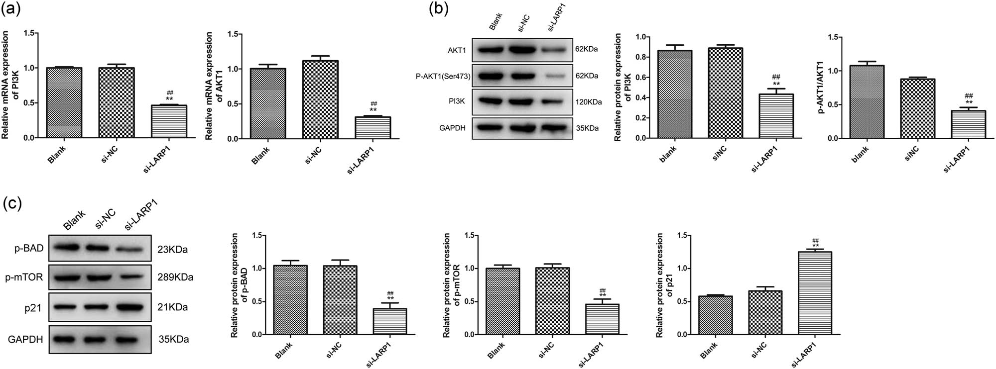 Figure 4
LARP1 knockdown suppresses the PI3K/AKT1 signaling pathway. (a) PI3K and AKT1 mRNA expression levels were determined using qRT-PCR. (b) Protein expression levels of PI3K, p-AKT1, and AKT1 were determined via western blotting. (c) Protein expression levels of p-BAD, p-mTOR, and p21 were determined via western blotting. **P < 0.01 compared with the blank group. ##
P < 0.01 compared with the si-NC group.