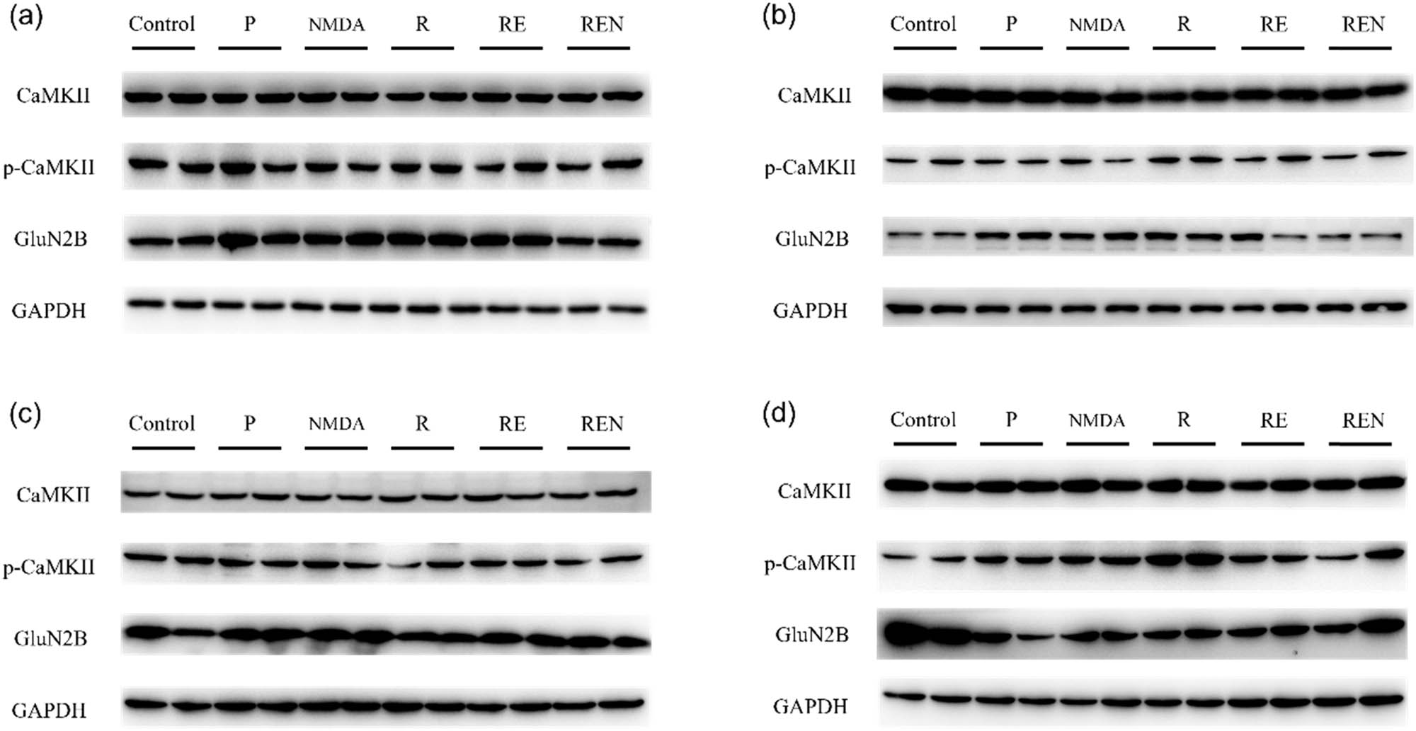 Figure 4
Effects of remifentanil combined with esketamine on the protein regulation of CaMKII and GluN2B in various timepoints post medication. (a) 0.5 h after drug administration. (b) 2 h after drug administration. (c) 5 h after drug administration. (d) 24 h after drug administration. (n = 2).